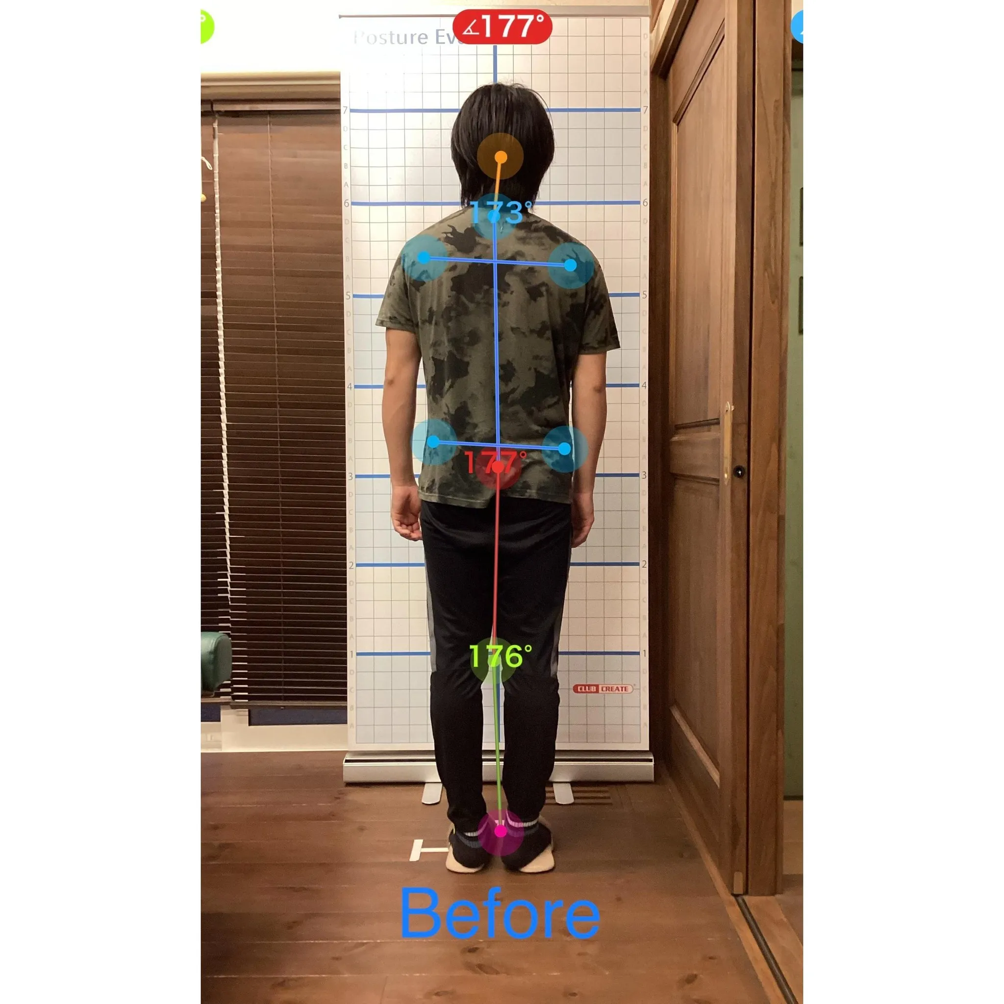 【富里 整体】背中の痛み、腰痛、肩の痛み 他/20代男性/障...