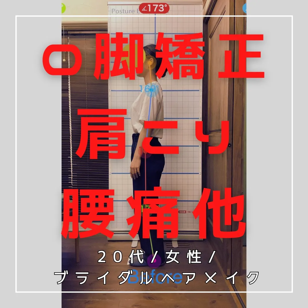 【富里 整体】O脚矯正、腰痛、肩こり 他/20代女性/ブライ...