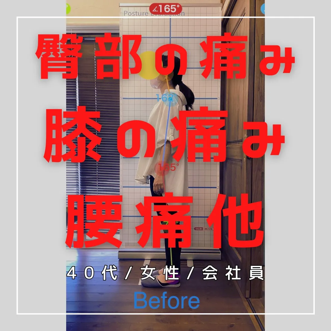 【富里 整体】腰痛、臀部の痛み、膝の痛み 他/40代女性/会...