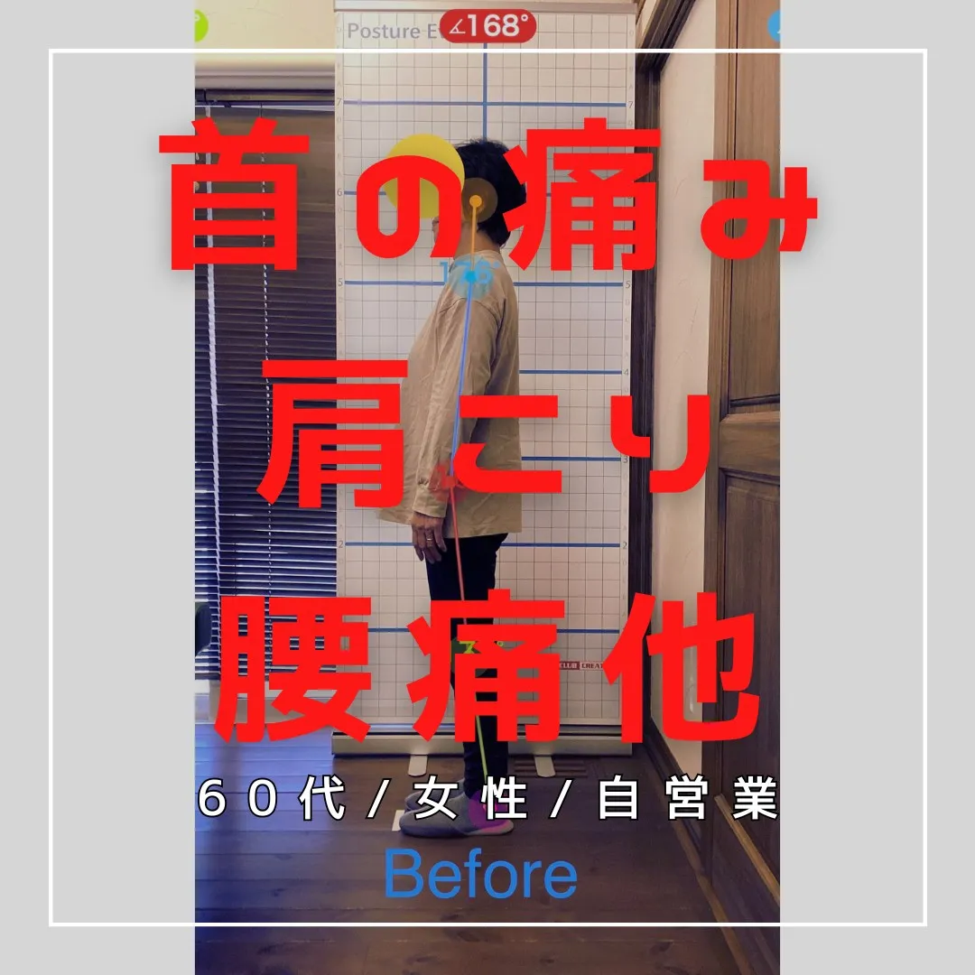 【富里 整体】首の痛み、肩こり、腰痛 他/60代女性/自営業