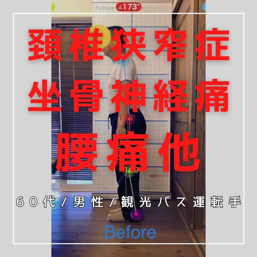 【富里 整体】坐骨神経痛、腰痛、頚椎狭窄症/60代男性/観光...