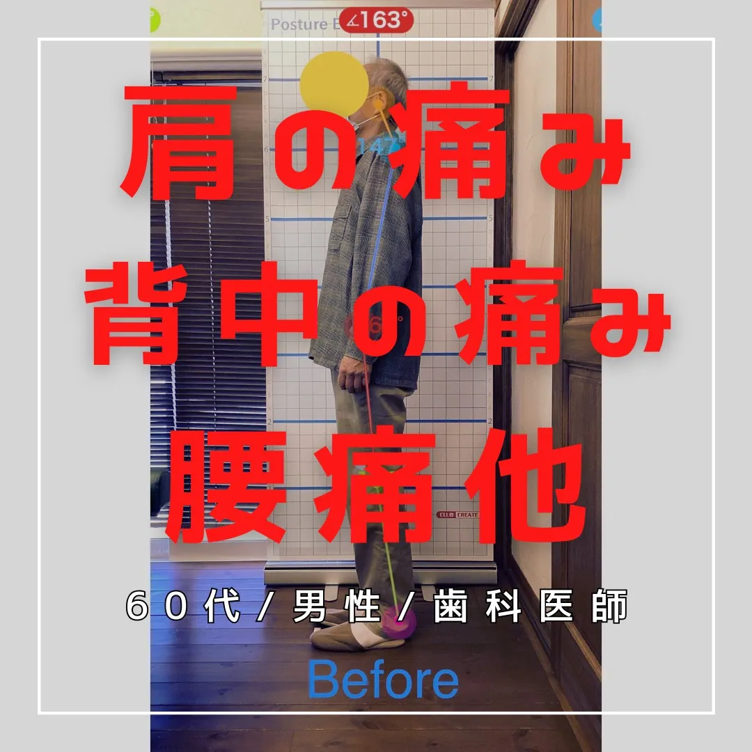 【富里 整体】腰痛、背中の痛み、肩の痛み 他/60代男性/歯...