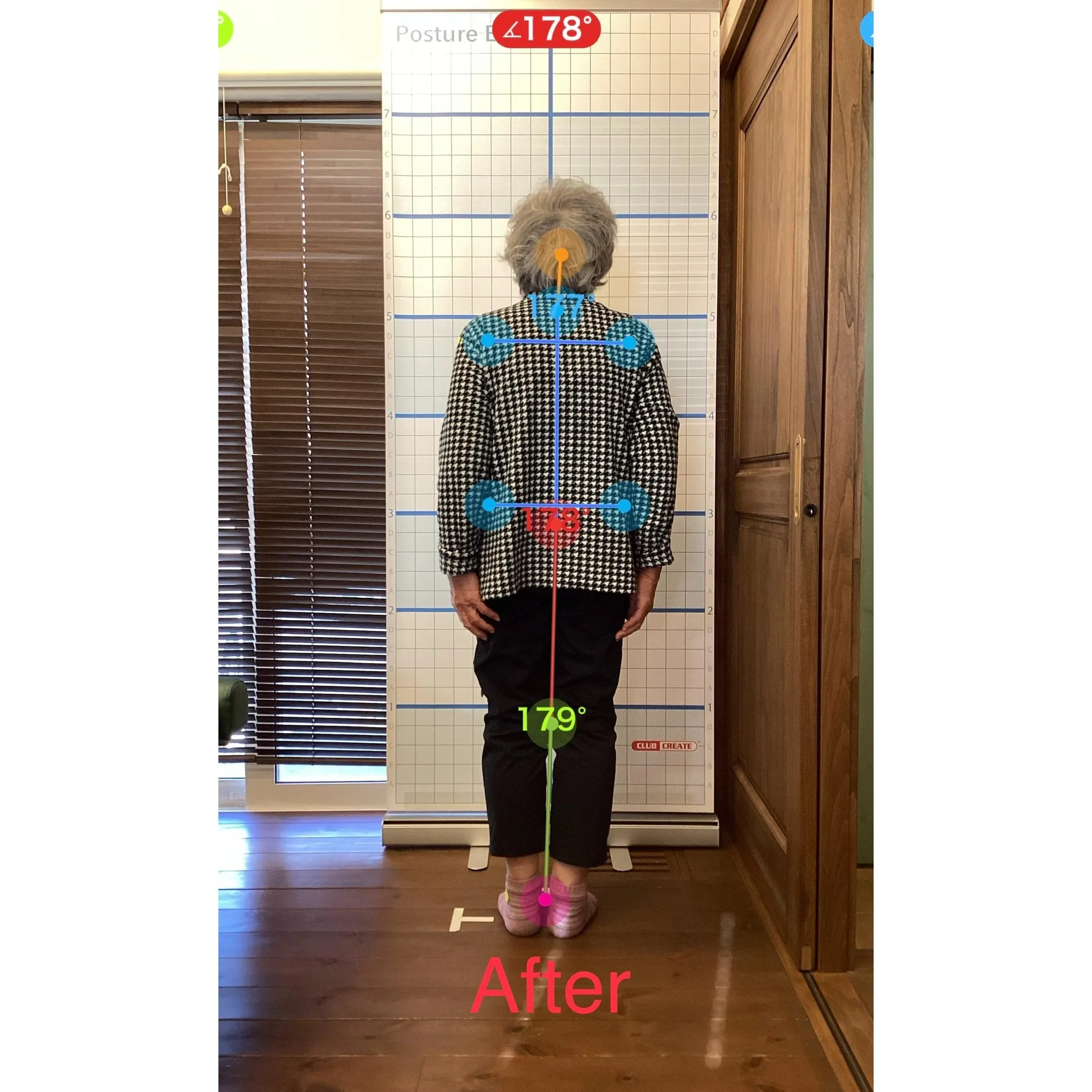 【富里 整体】肩こり、背中の痛み、腰痛 他/80代女性/主婦