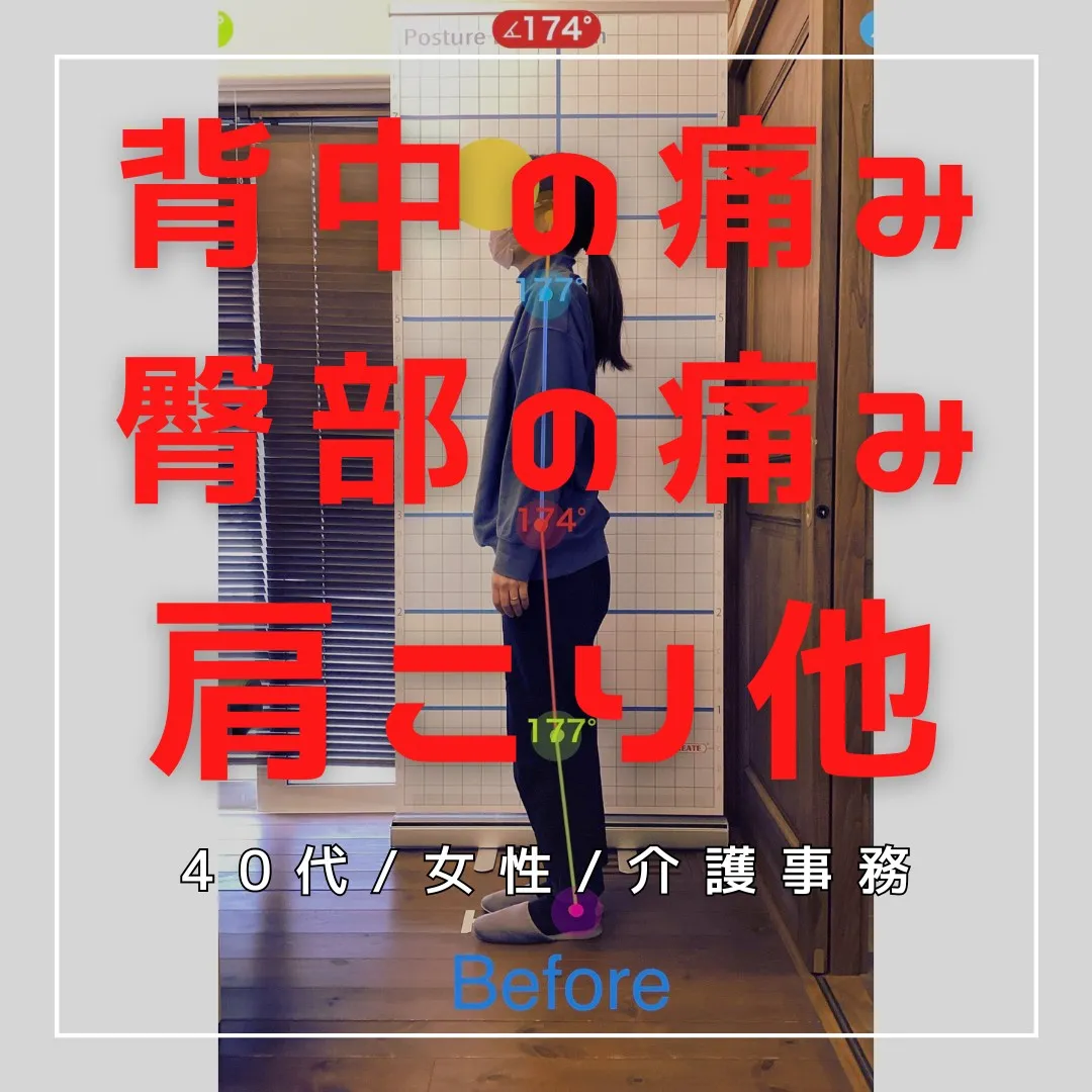 【富里 整体】背中の痛み、肩こり、臀部の痛み/40代女性/介...