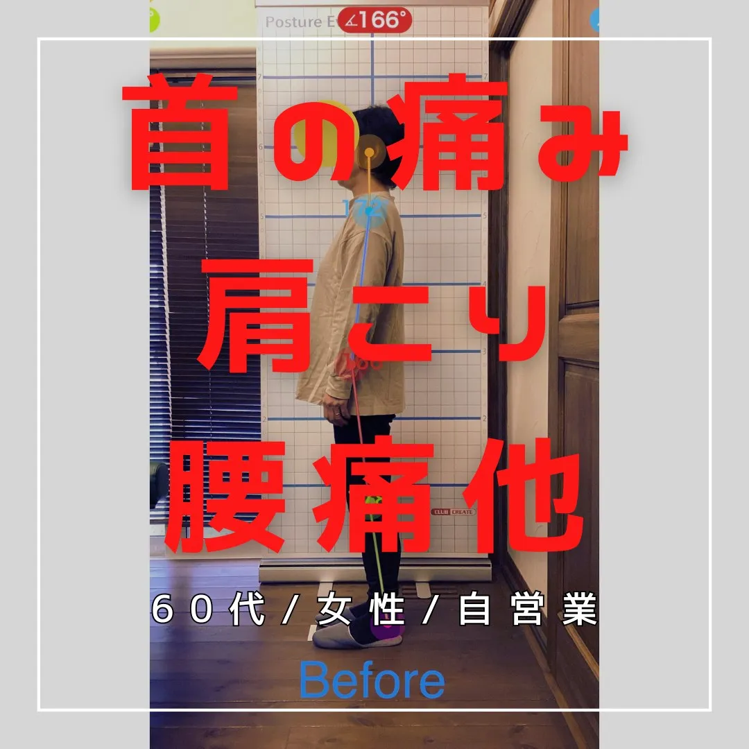 【富里 整体】首の痛み、肩こり、腰痛 他/60代女性/自営業