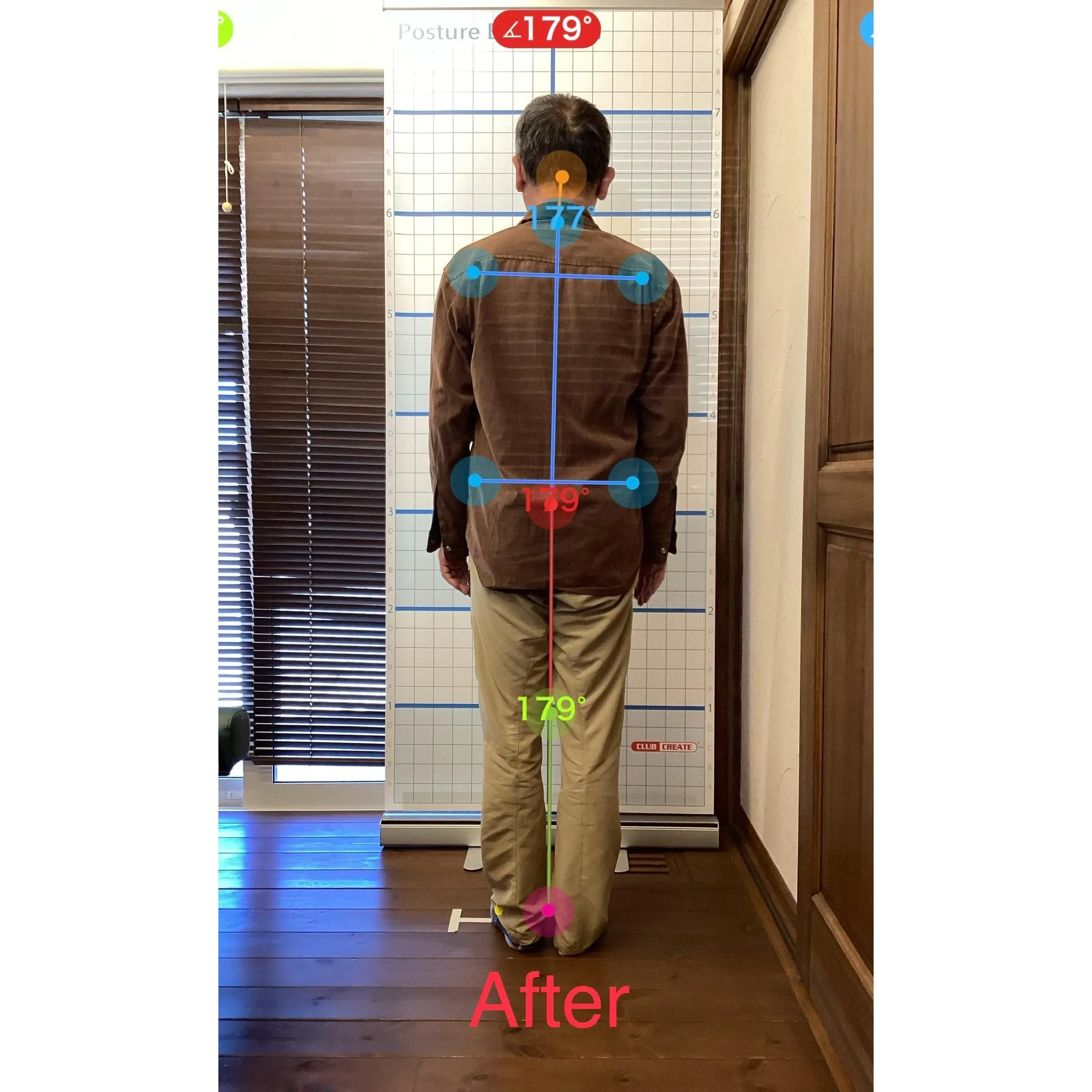 【富里 整体】首肩の痛み、腕のシビレ、腰痛 他/50代男性/...