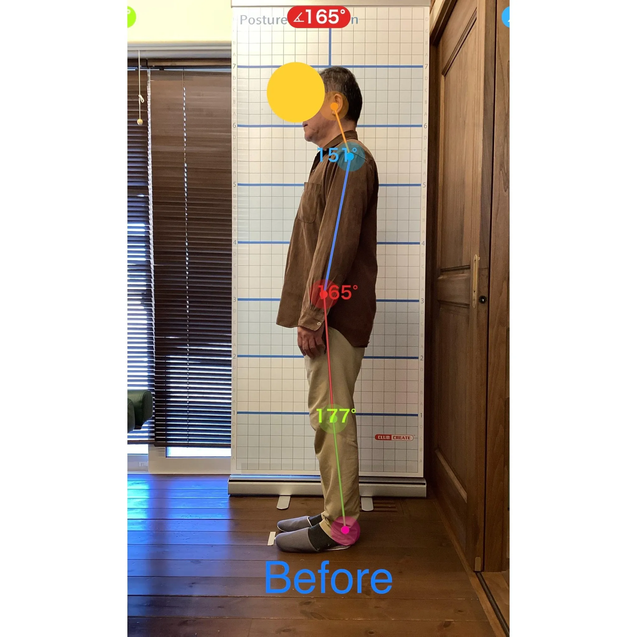 【富里 整体】首肩の痛み、腕のシビレ、腰痛 他/50代男性/...