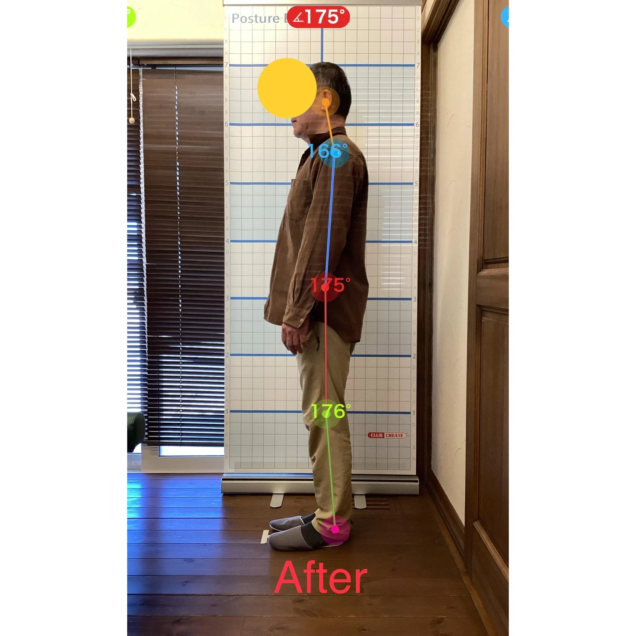 【富里 整体】首肩の痛み、腕のシビレ、腰痛 他/50代男性/...