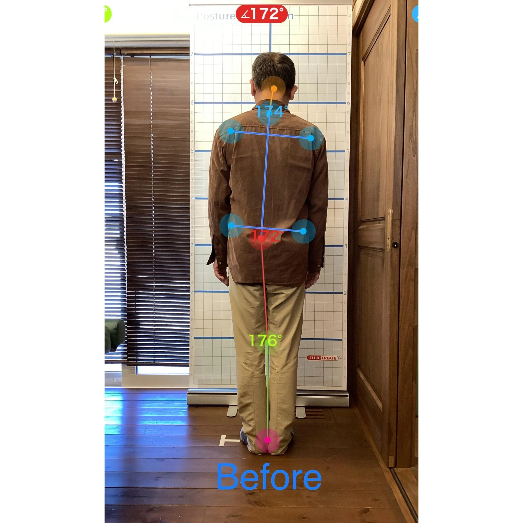 【富里 整体】首肩の痛み、腕のシビレ、腰痛 他/50代男性/...