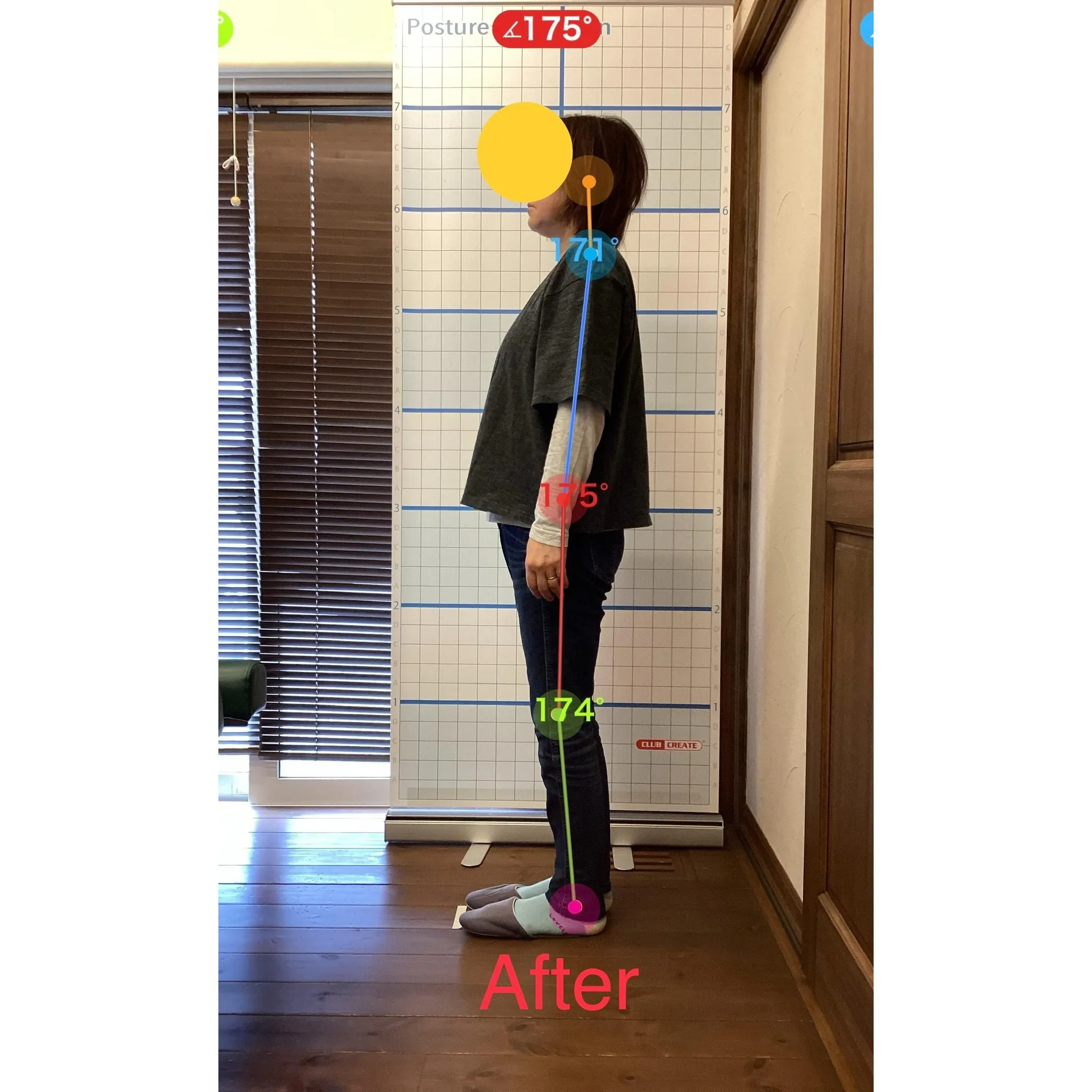 【富里 整体】姿勢改善、肩こり、腰痛 他/50代女性/ウェイ...