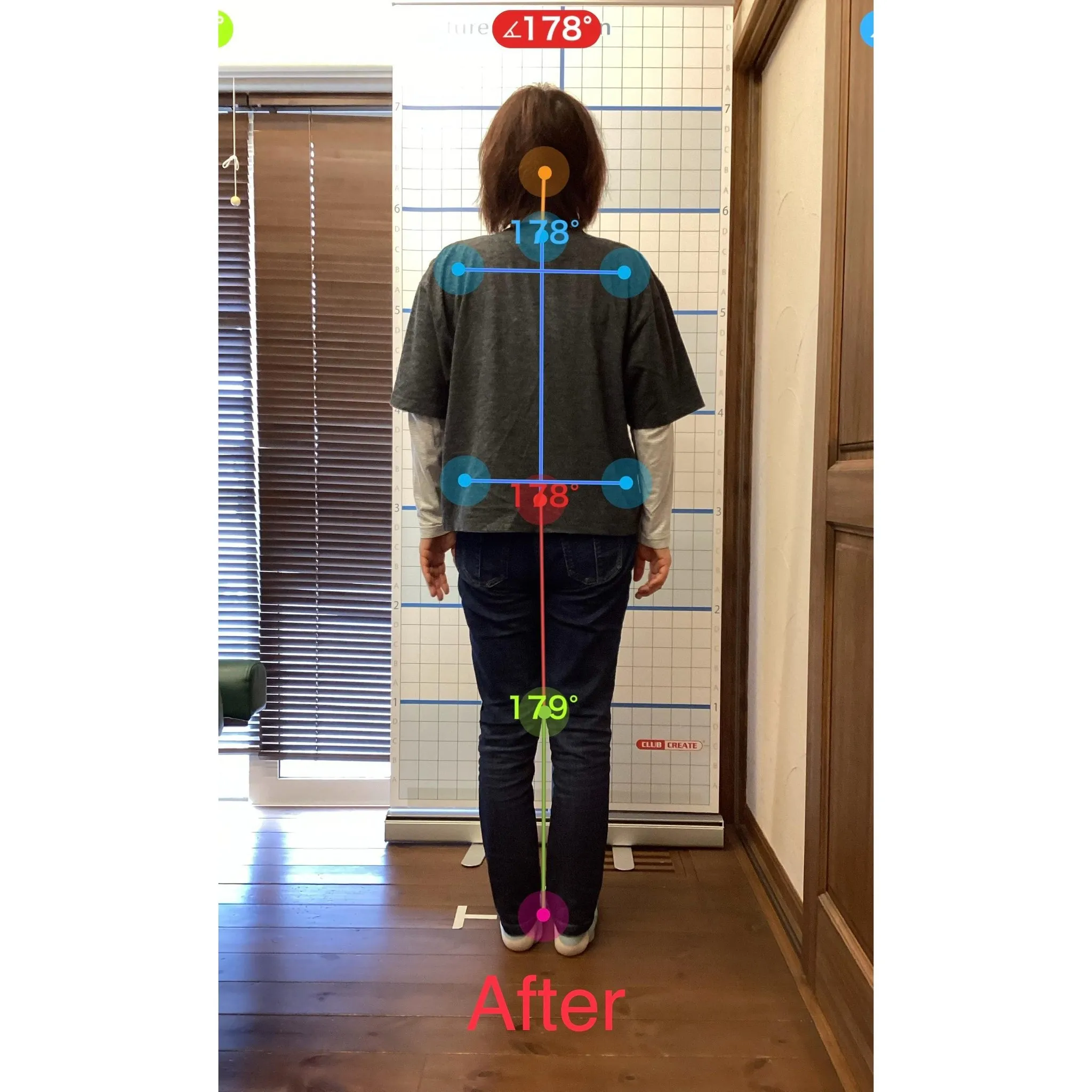 【富里 整体】姿勢改善、肩こり、腰痛 他/50代女性/ウェイ...