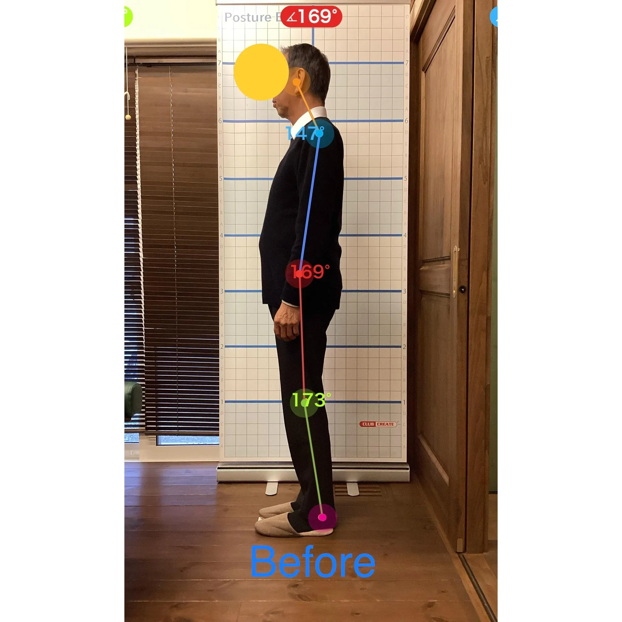 【富里 整体】坐骨神経痛、脚の痛み、肘の痛み/60代男性/製...