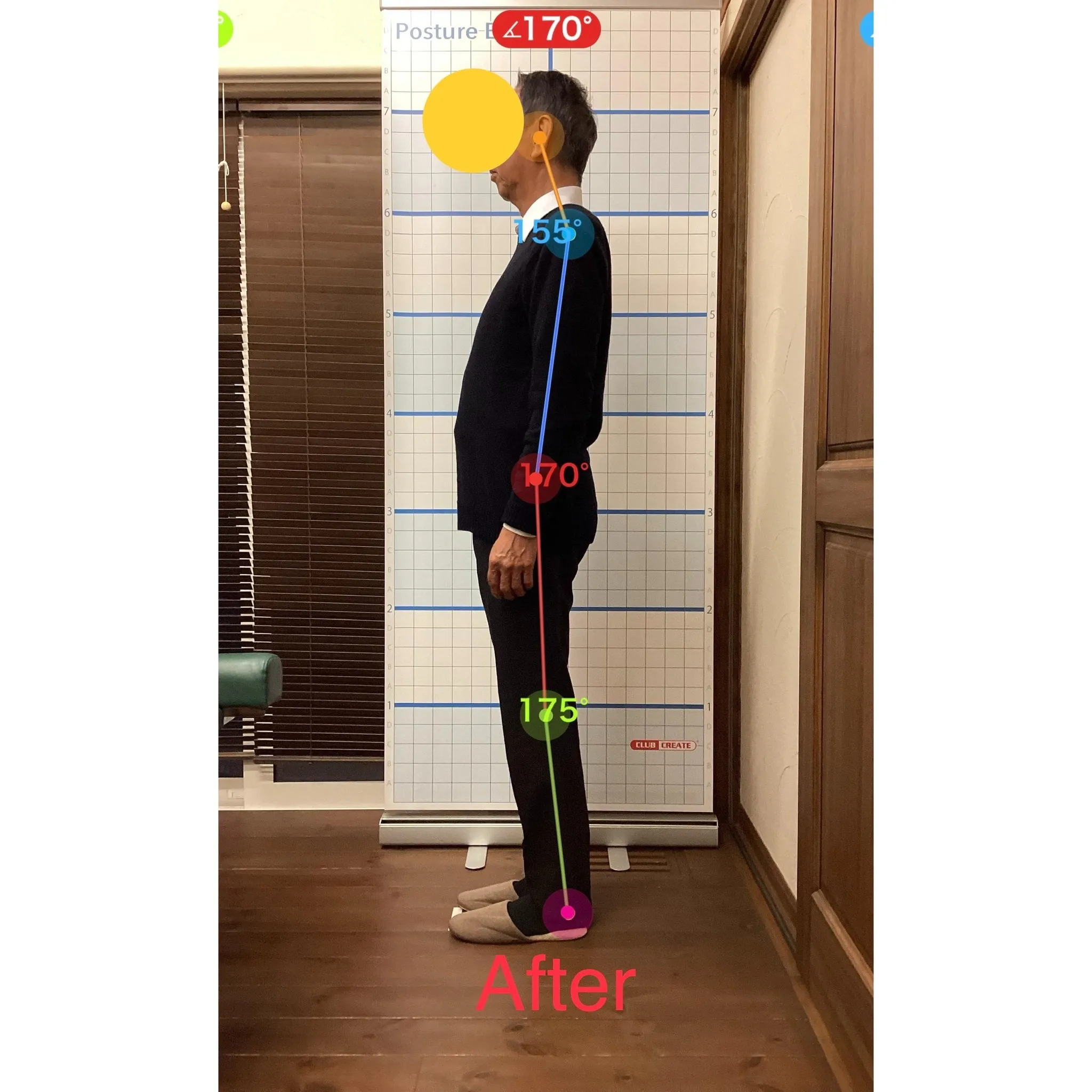 【富里 整体】坐骨神経痛、脚の痛み、肘の痛み/60代男性/製...