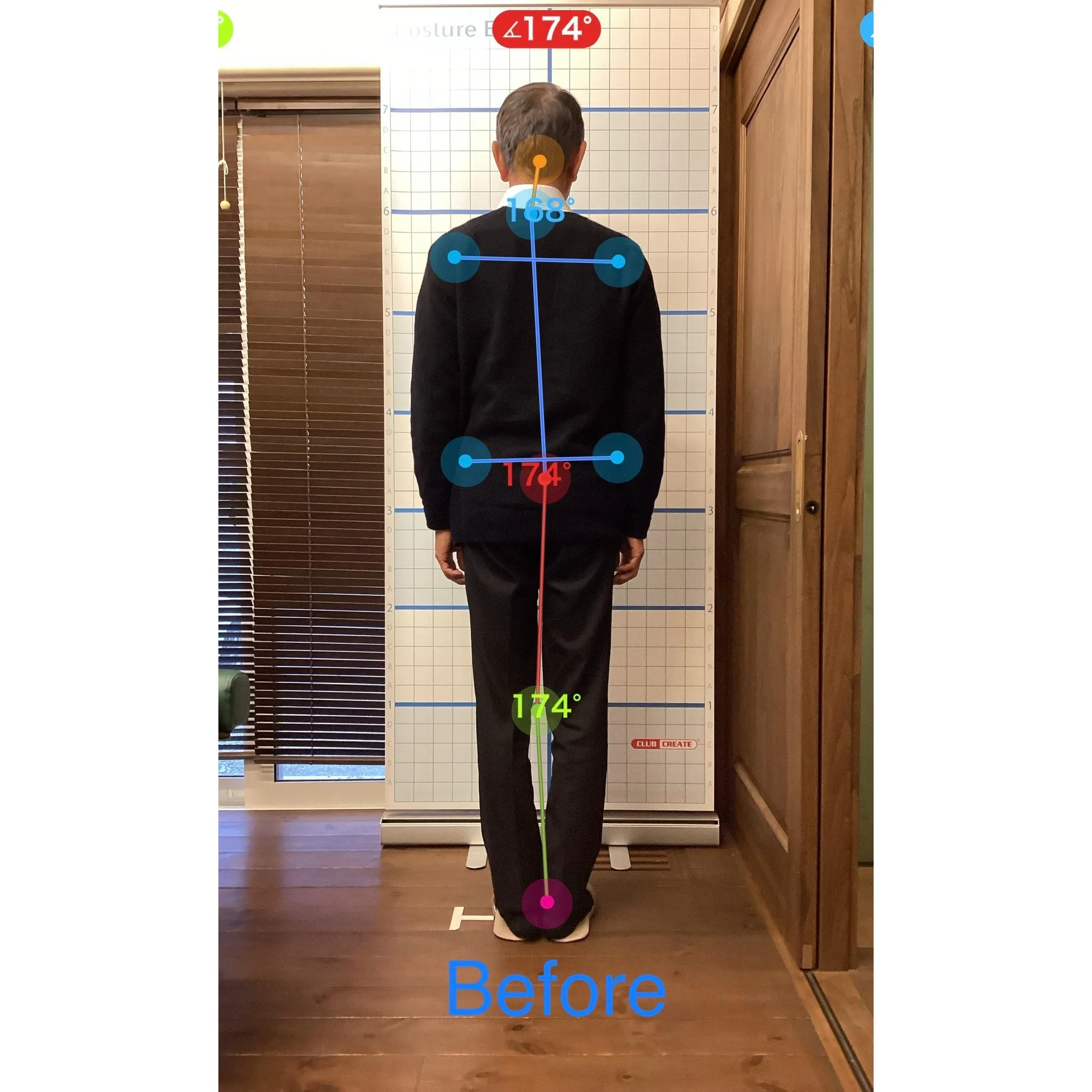 【富里 整体】坐骨神経痛、脚の痛み、肘の痛み/60代男性/製...