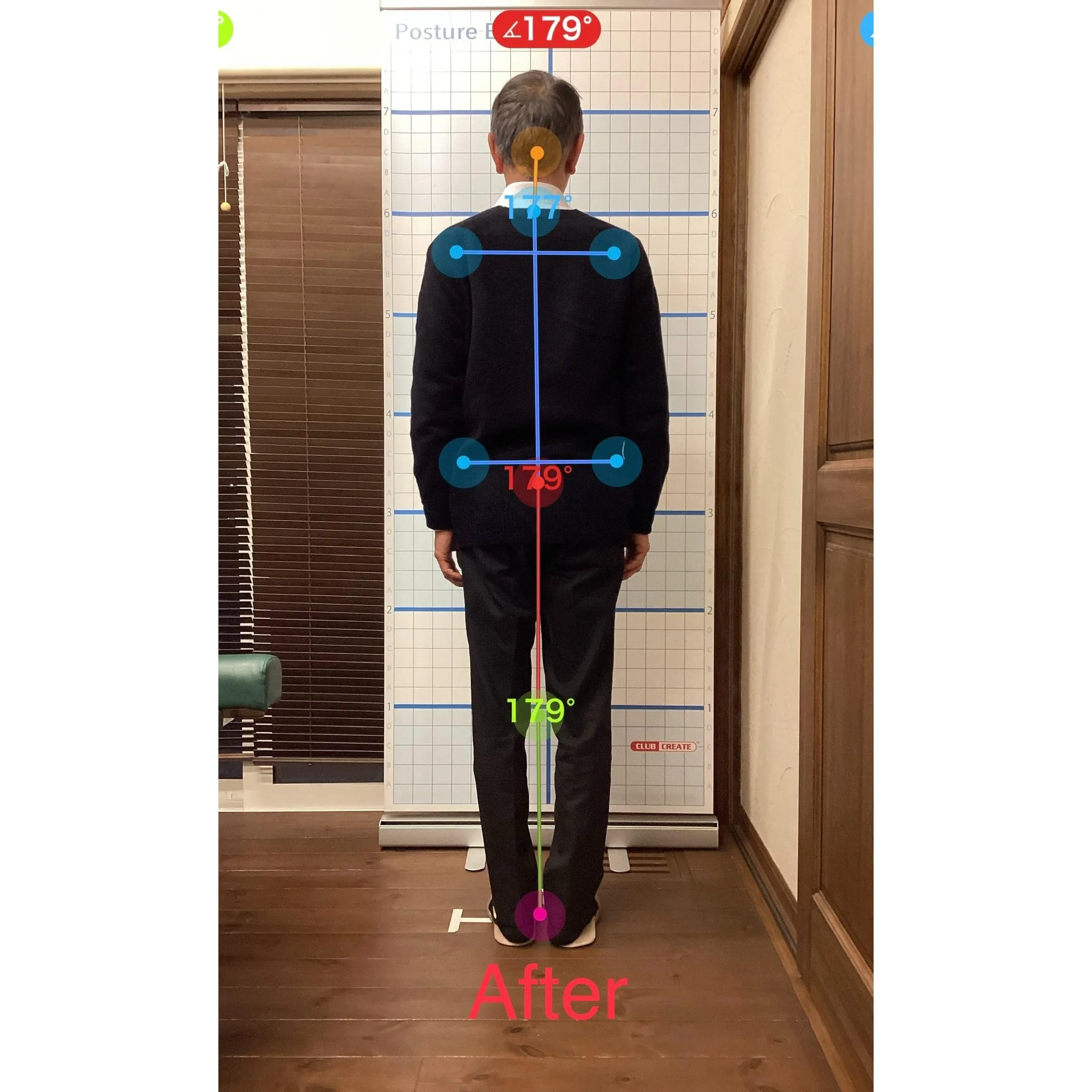 【富里 整体】坐骨神経痛、脚の痛み、肘の痛み/60代男性/製...
