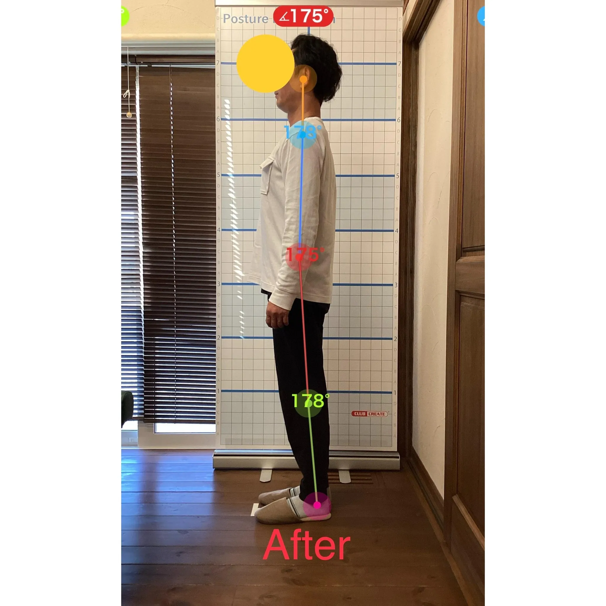 【富里 整体】背中の痛み、肩こり、猫背 他/40代男性/会社...