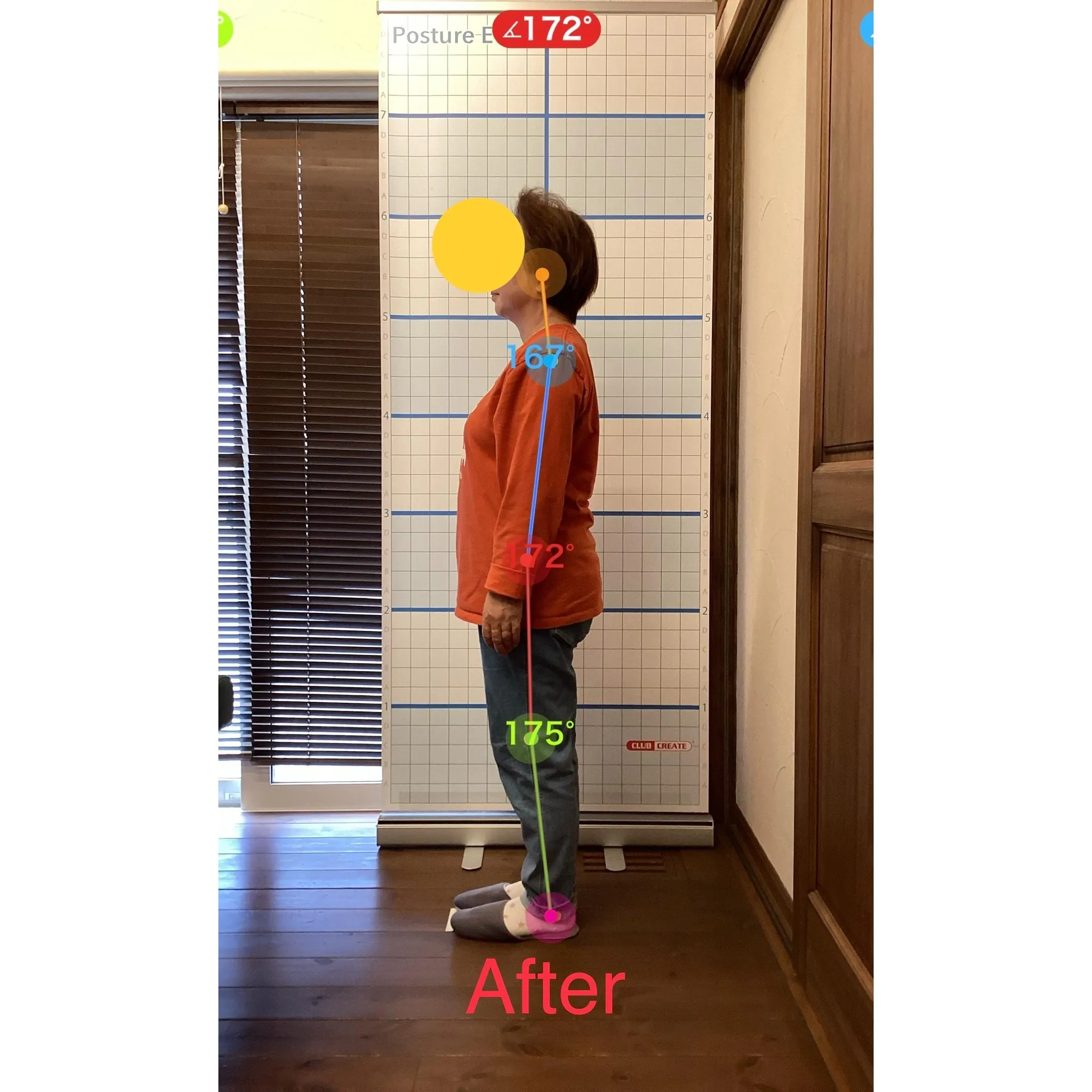 【富里 整体】腰痛、臀部の痛み、頭痛 他/60代女性/主婦