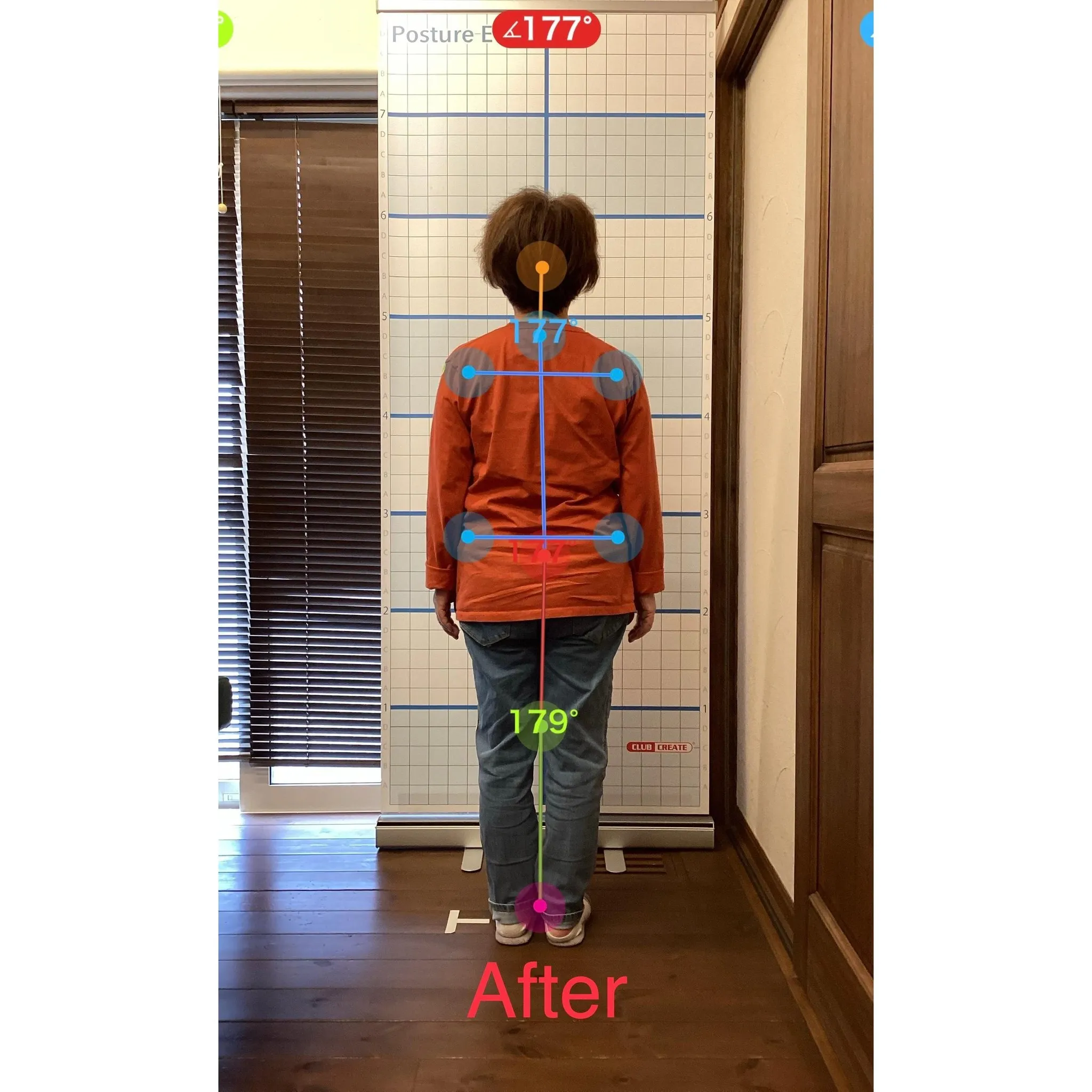 【富里 整体】腰痛、臀部の痛み、頭痛 他/60代女性/主婦