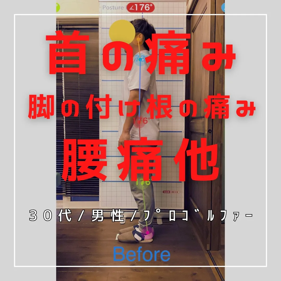 【富里 整体】首の痛み、頭痛、脚の付け根の痛み 他/30代男...
