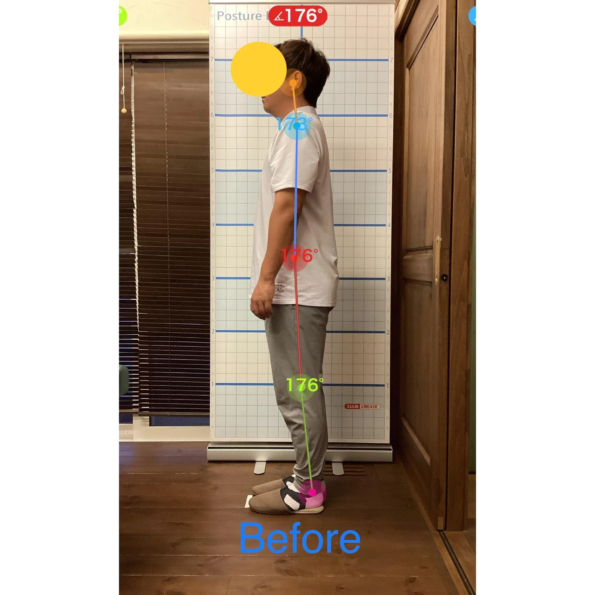 【富里 整体】首の痛み、頭痛、脚の付け根の痛み 他/30代男...