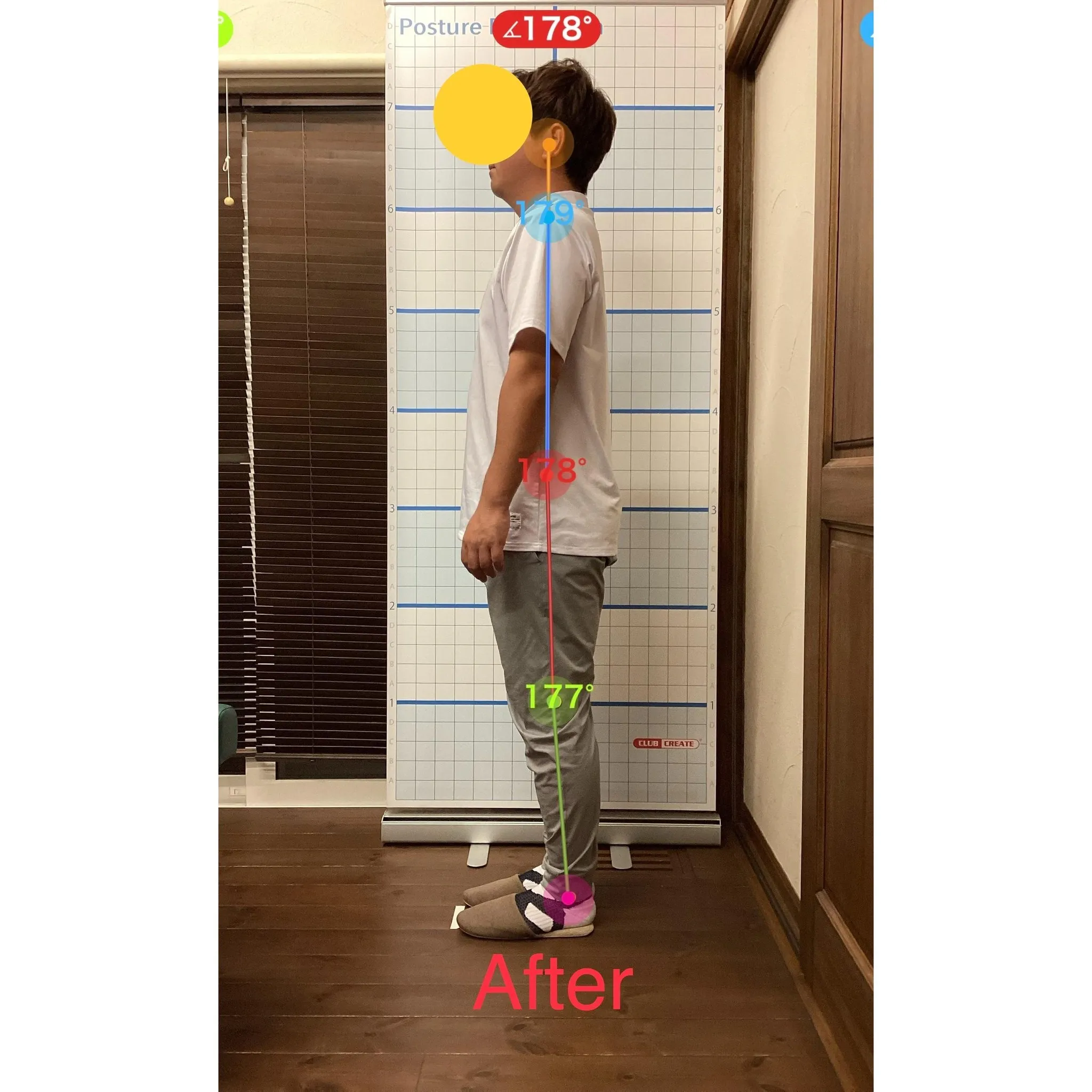 【富里 整体】首の痛み、頭痛、脚の付け根の痛み 他/30代男...