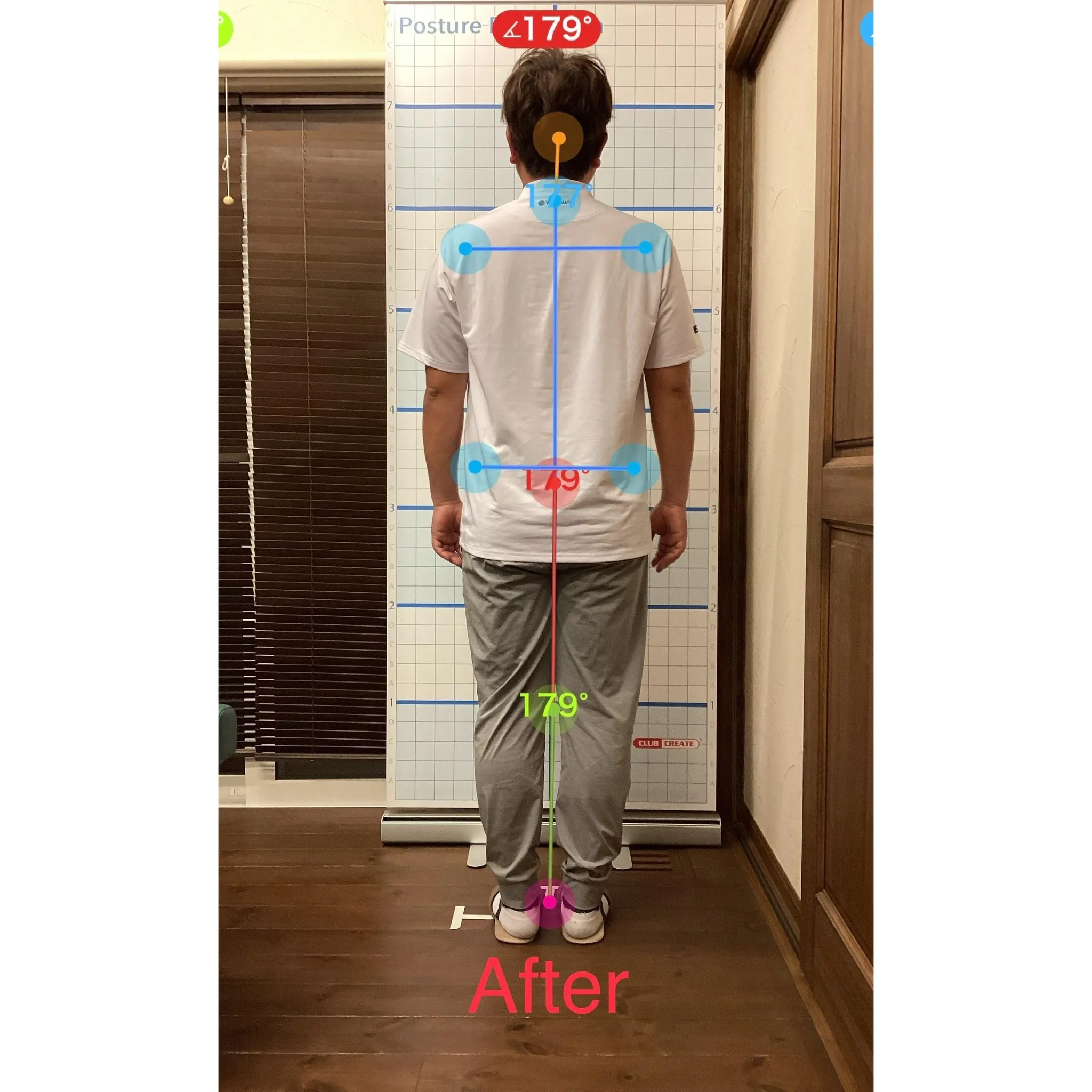 【富里 整体】首の痛み、頭痛、脚の付け根の痛み 他/30代男...