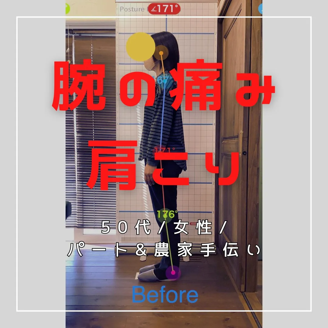 【富里 整体】腕の痛み、肩こり/50代女性/農家手伝い&パー...