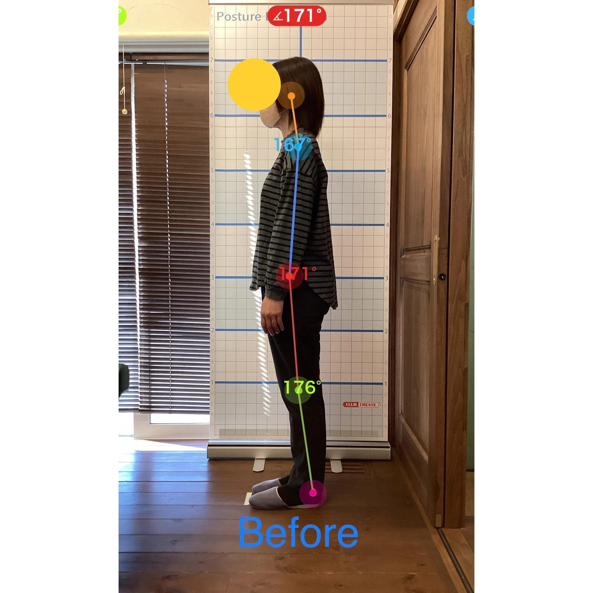 【富里 整体】腕の痛み、肩こり/50代女性/農家手伝い&パー...