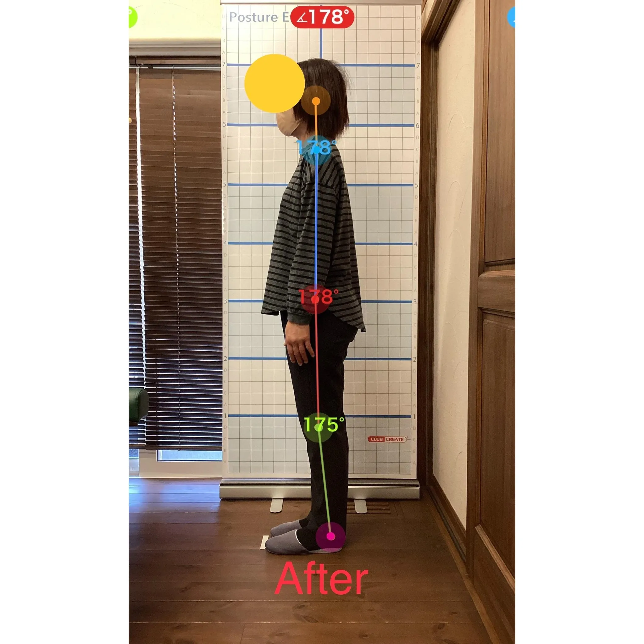 【富里 整体】腕の痛み、肩こり/50代女性/農家手伝い&パー...