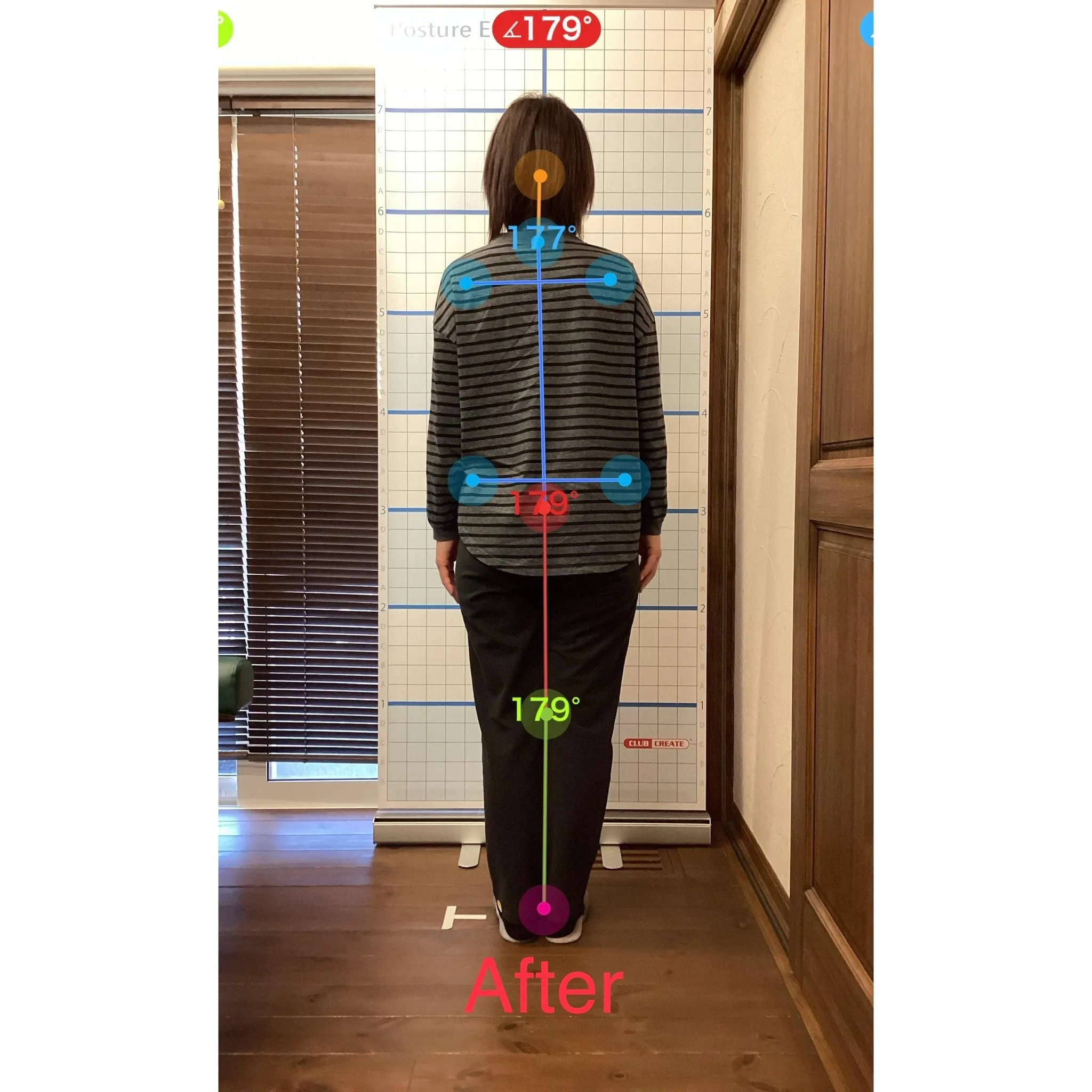 【富里 整体】腕の痛み、肩こり/50代女性/農家手伝い&パー...