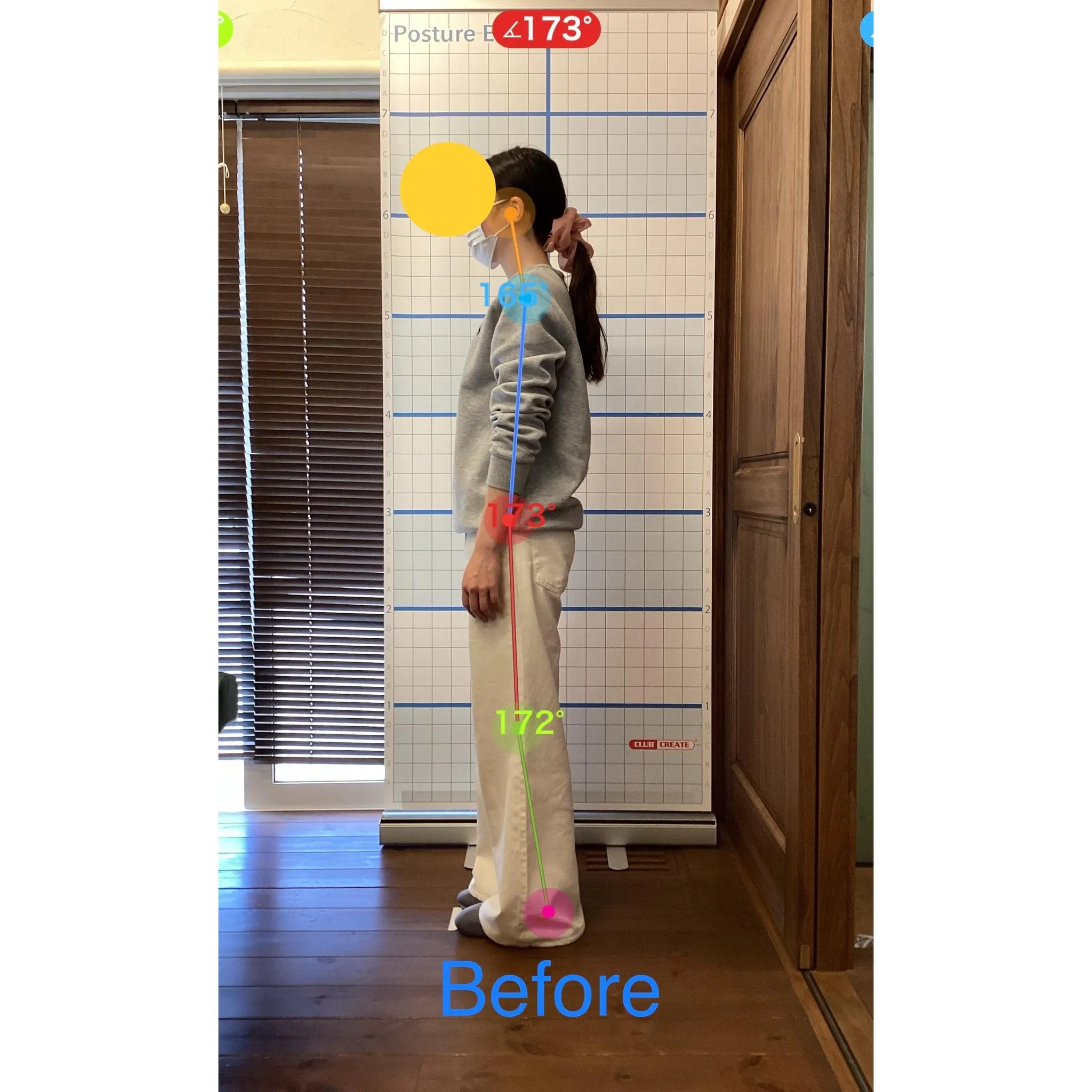 【富里 整体】左大腿のシビレ、首が重い、頭痛 他/20代女性...