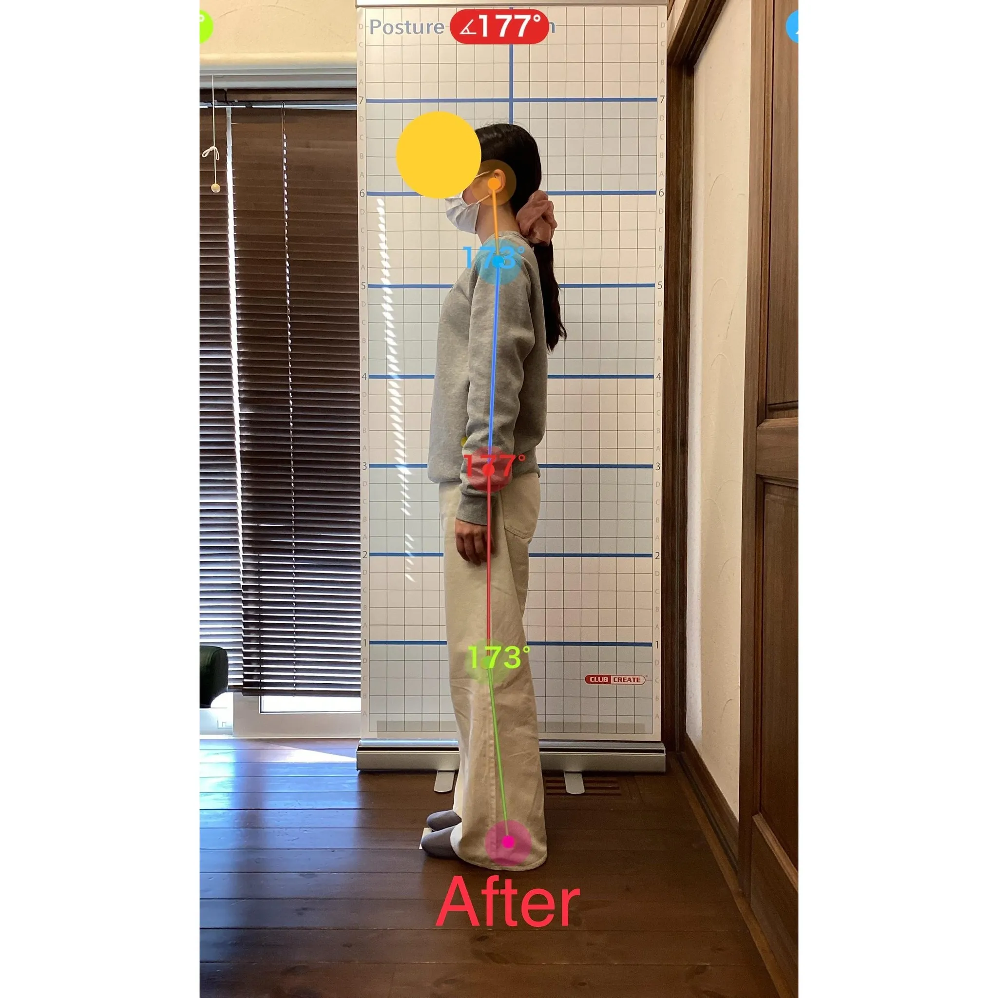 【富里 整体】左大腿のシビレ、首が重い、頭痛 他/20代女性...