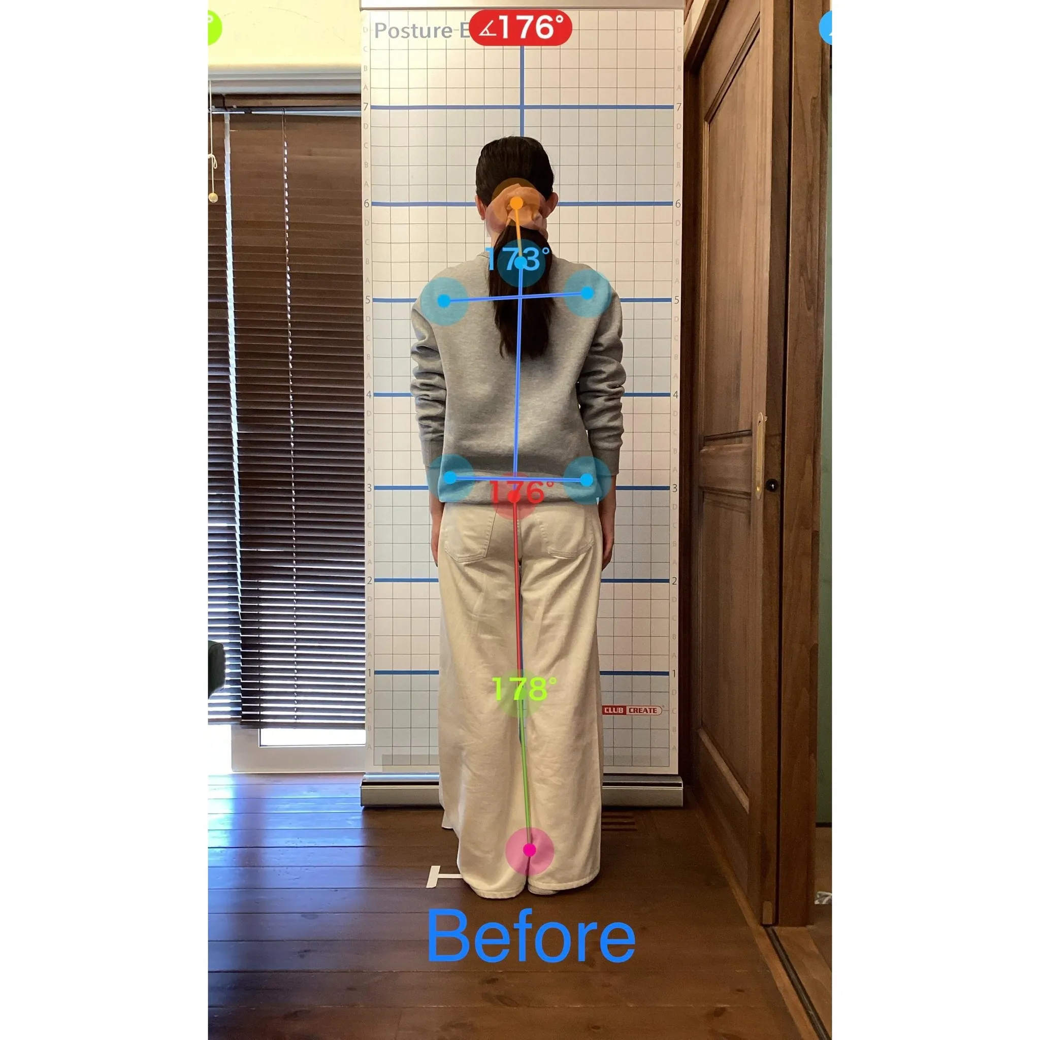 【富里 整体】左大腿のシビレ、首が重い、頭痛 他/20代女性...