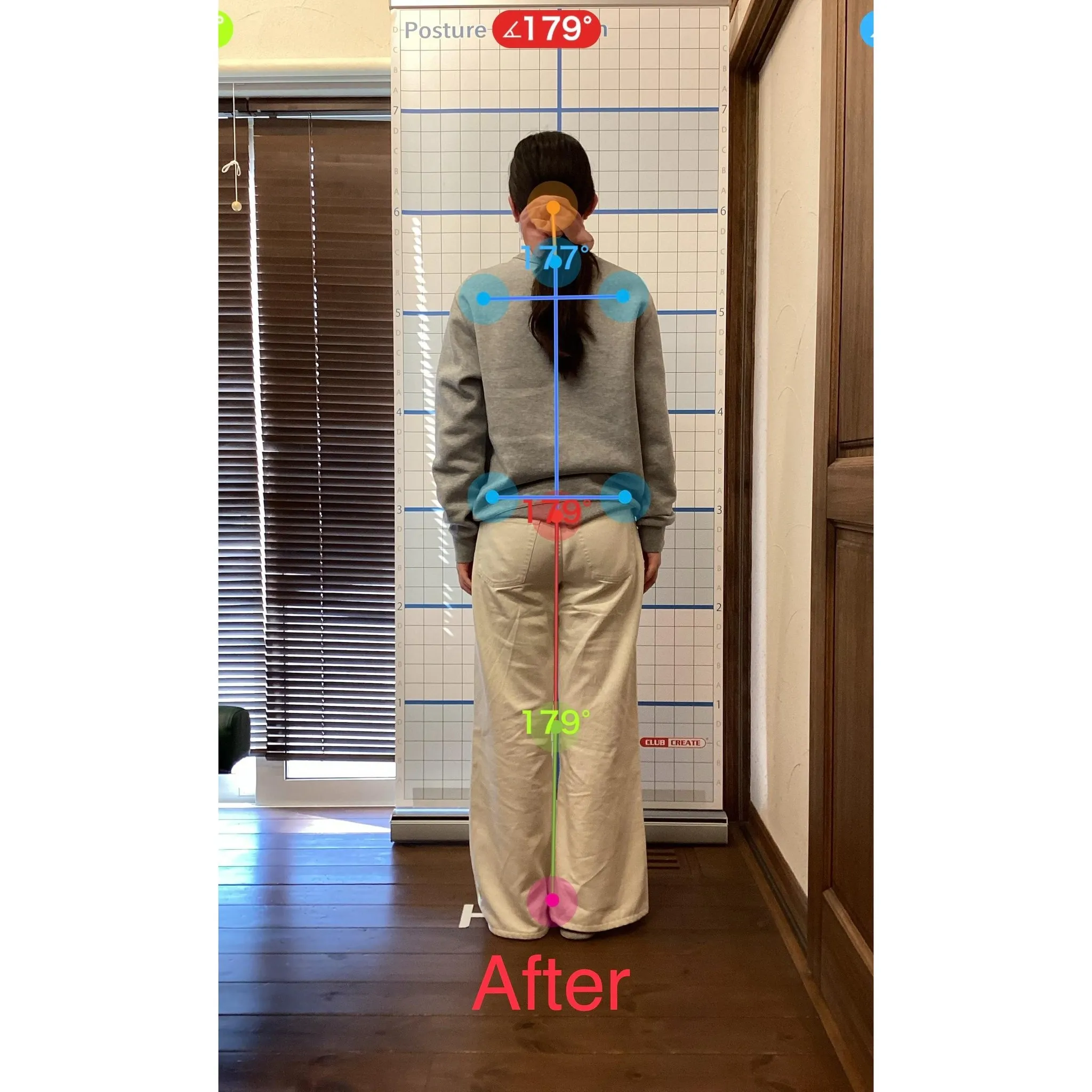 【富里 整体】左大腿のシビレ、首が重い、頭痛 他/20代女性...