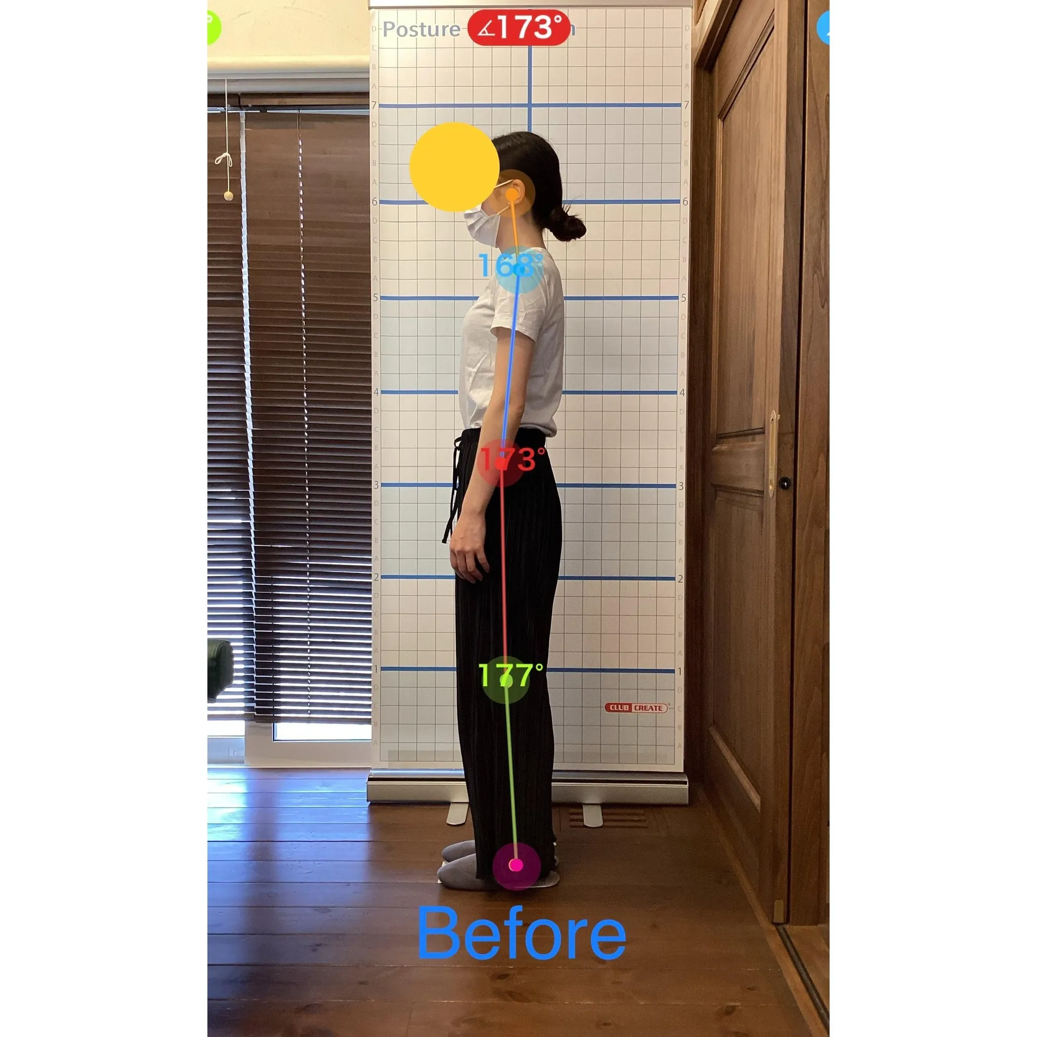 【富里 整体】左大腿のシビレ、首が重い、頭痛 他/20代女性...