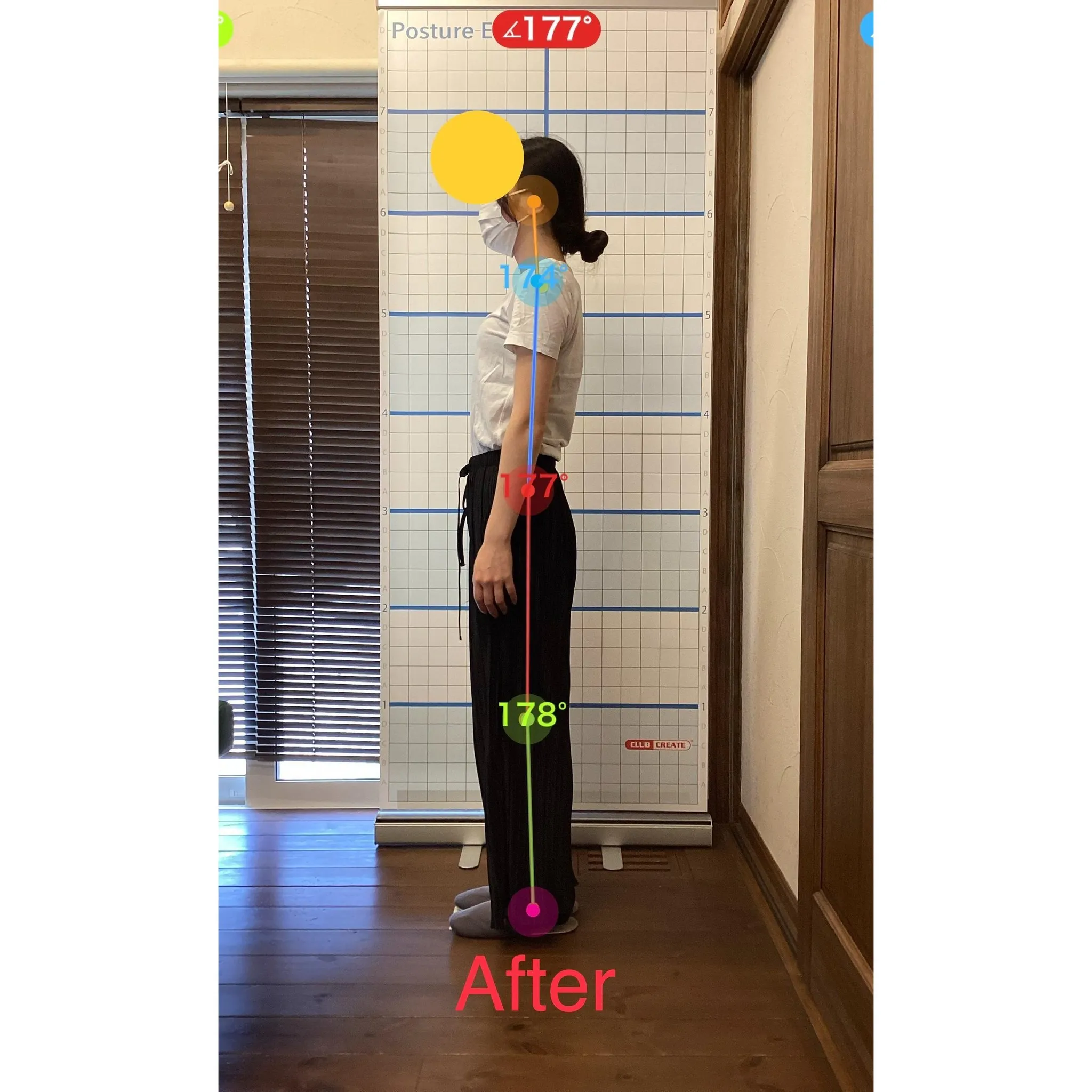 【富里 整体】左大腿のシビレ、首が重い、頭痛 他/20代女性...