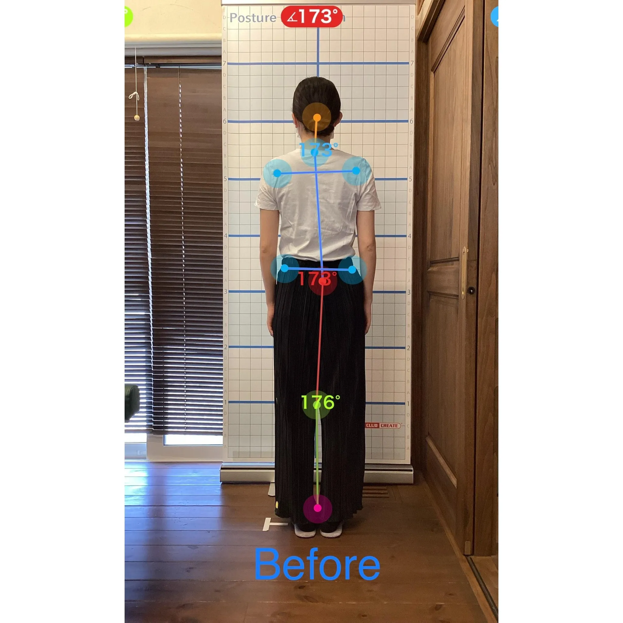 【富里 整体】左大腿のシビレ、首が重い、頭痛 他/20代女性...