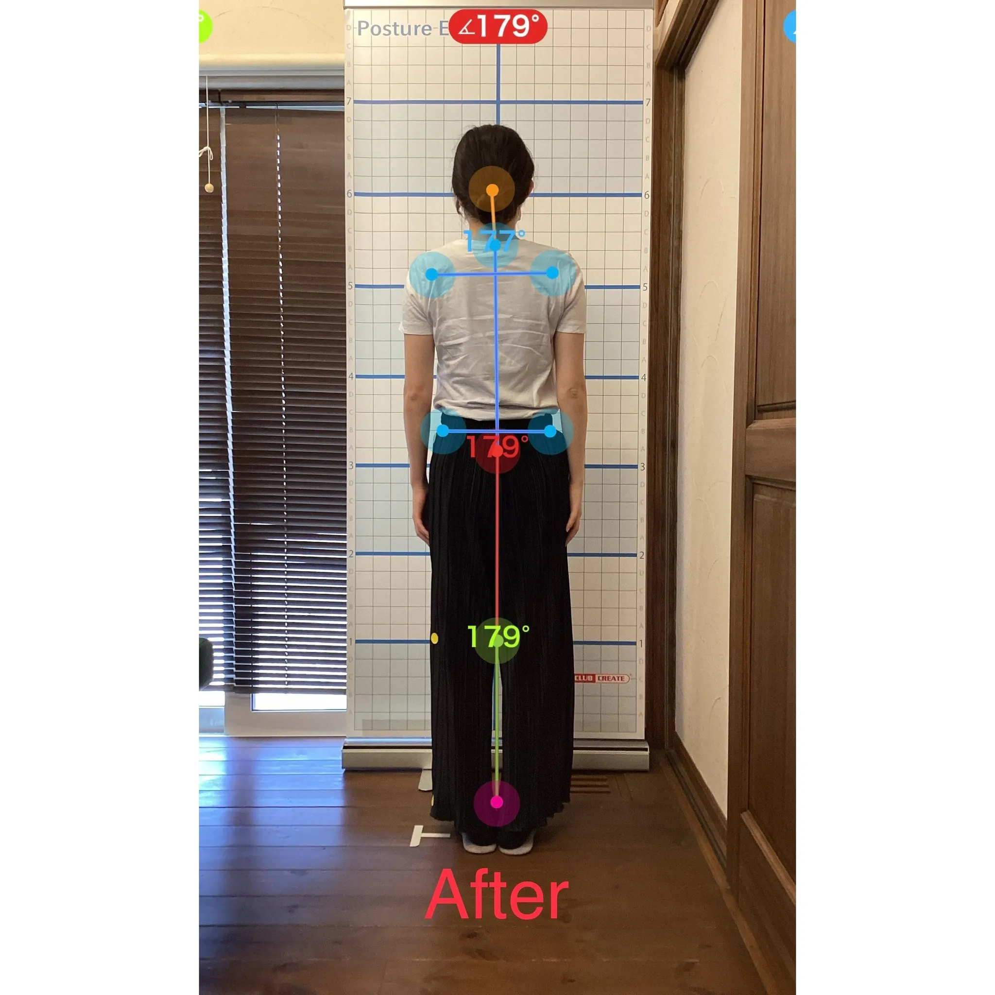 【富里 整体】左大腿のシビレ、首が重い、頭痛 他/20代女性...