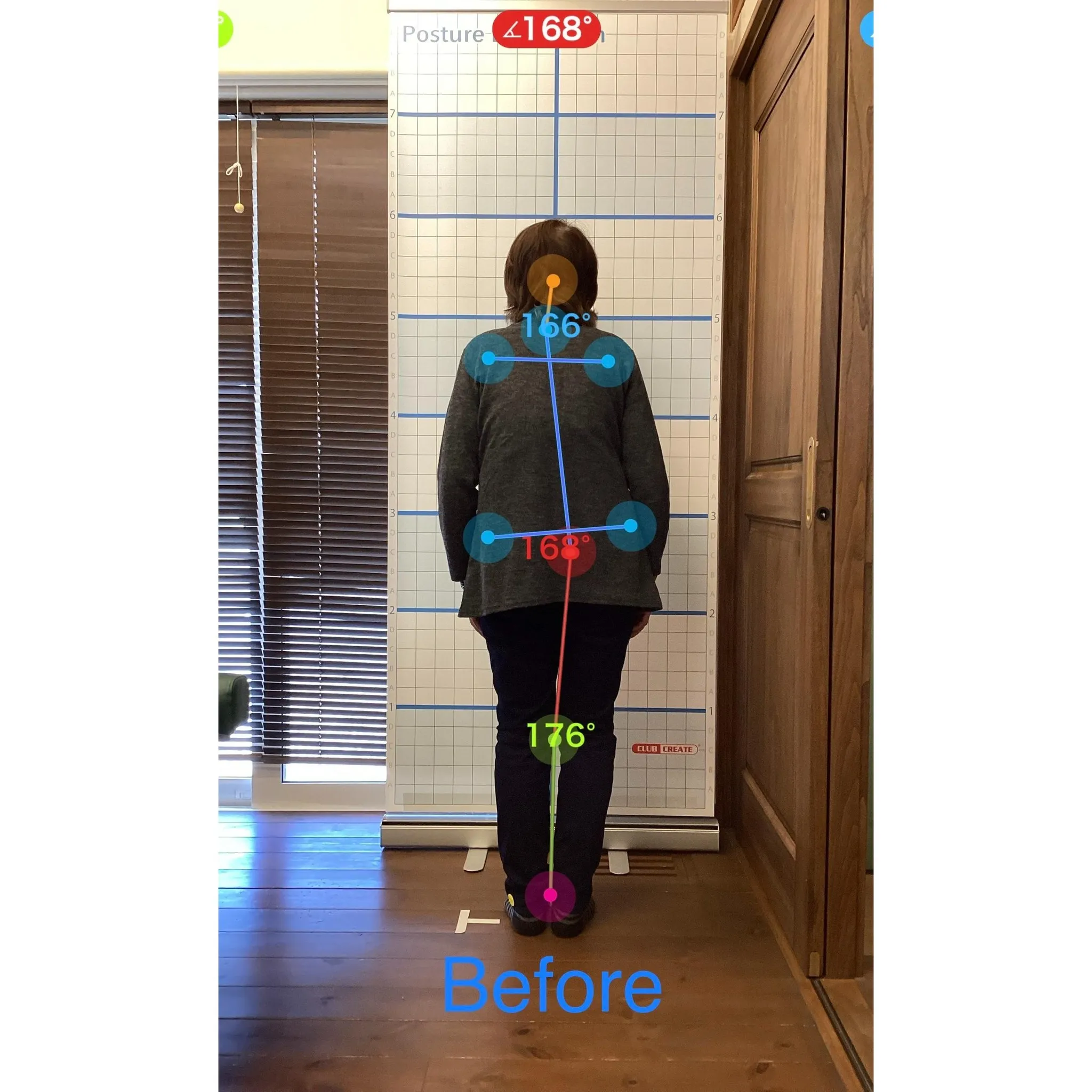 【富里 整体】背中の痛み、腰痛、姿勢改善 他/70代女性/農...