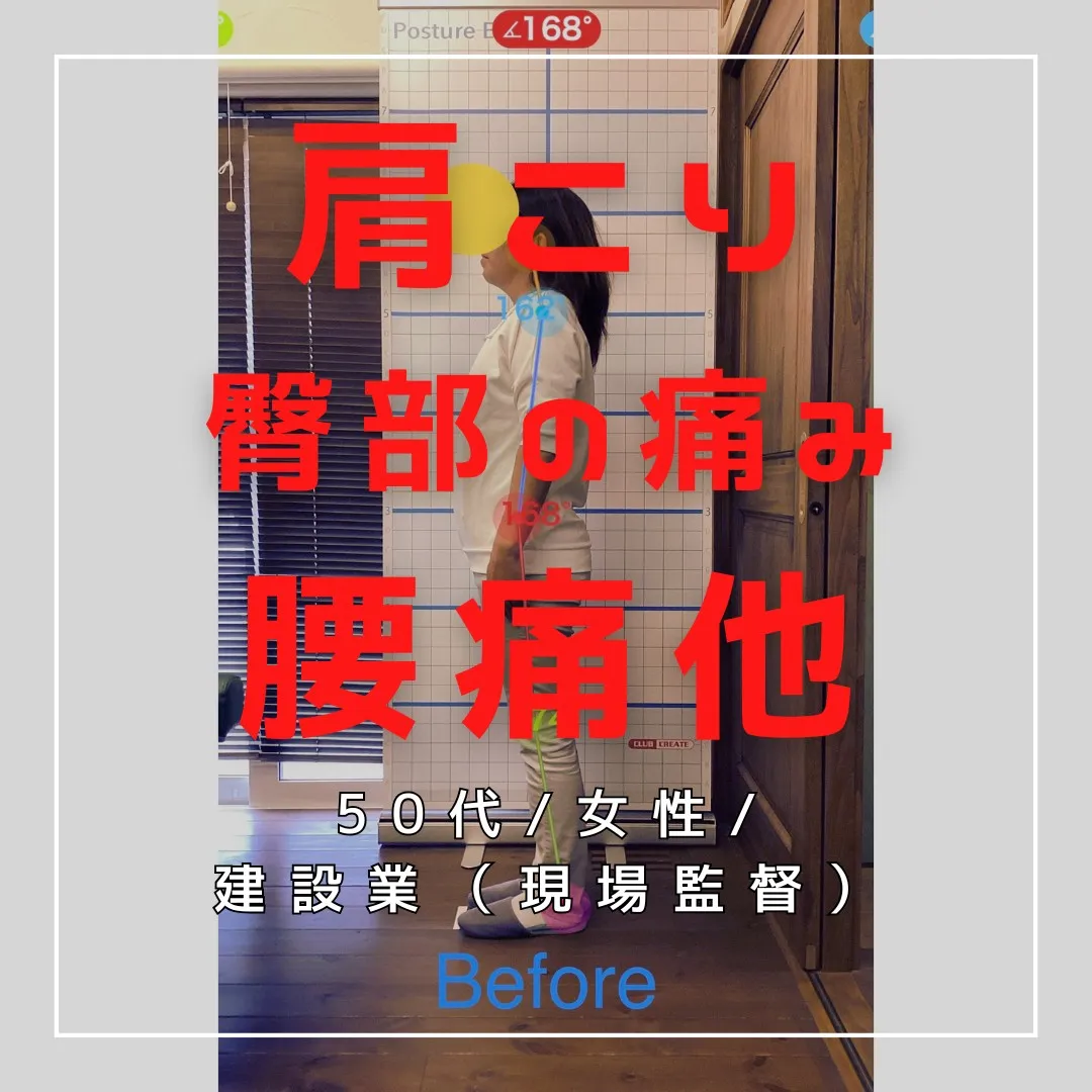 【富里 整体】臀部の痛み、腰痛、肩こり 他/50代女性/建設...