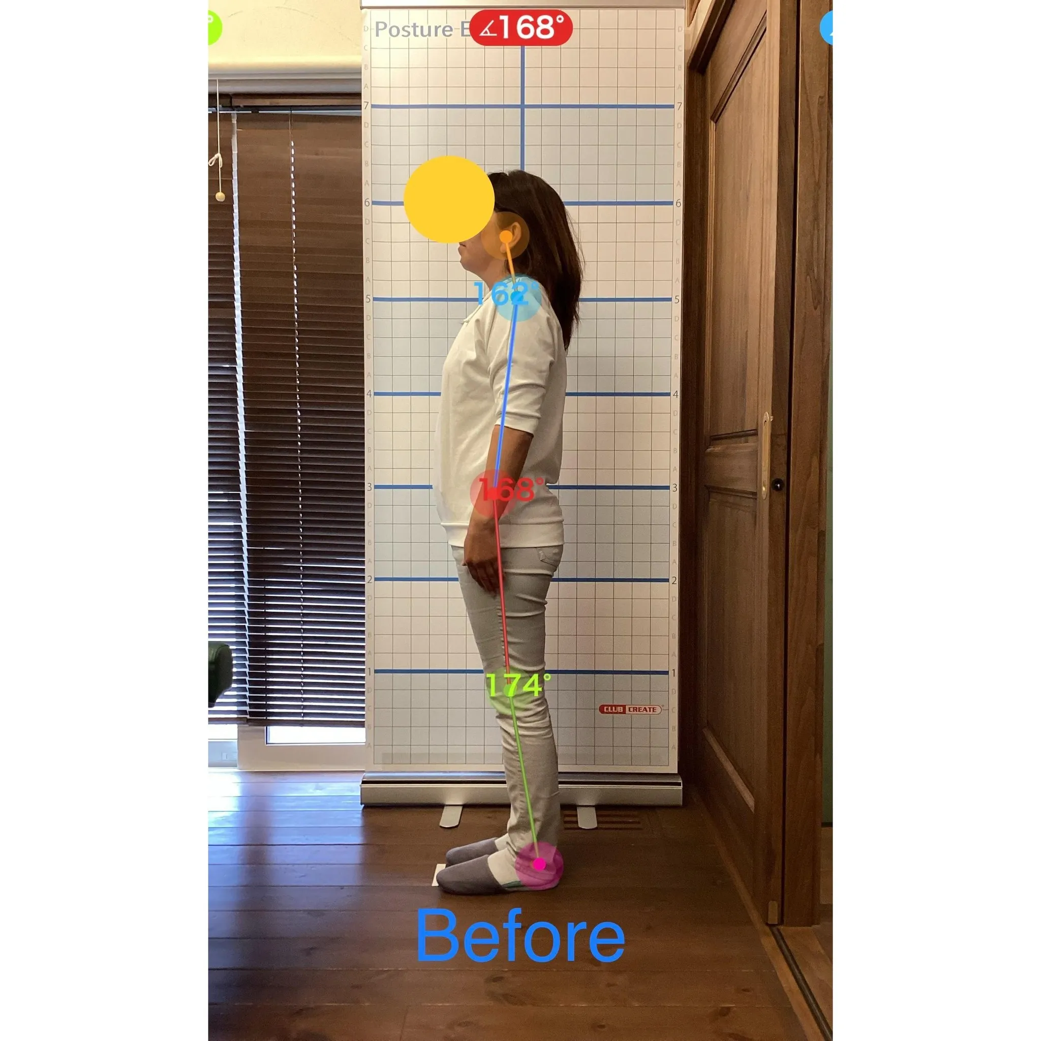 【富里 整体】臀部の痛み、腰痛、肩こり 他/50代女性/建設...