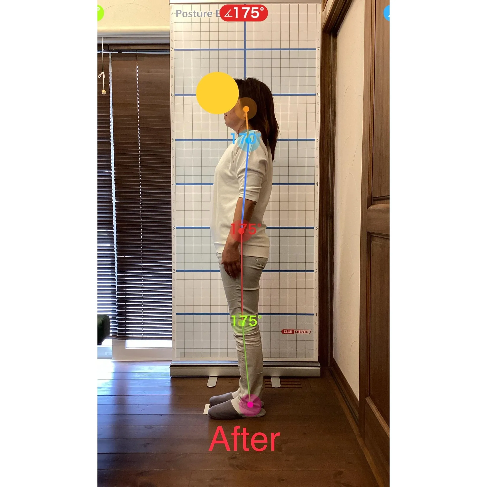 【富里 整体】臀部の痛み、腰痛、肩こり 他/50代女性/建設...