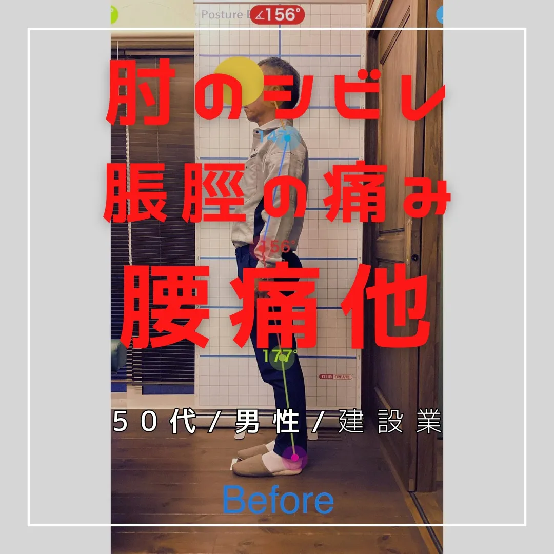 【富里 整体】腰痛、肘のシビレ、脹脛の痛み 他/50代男性/...