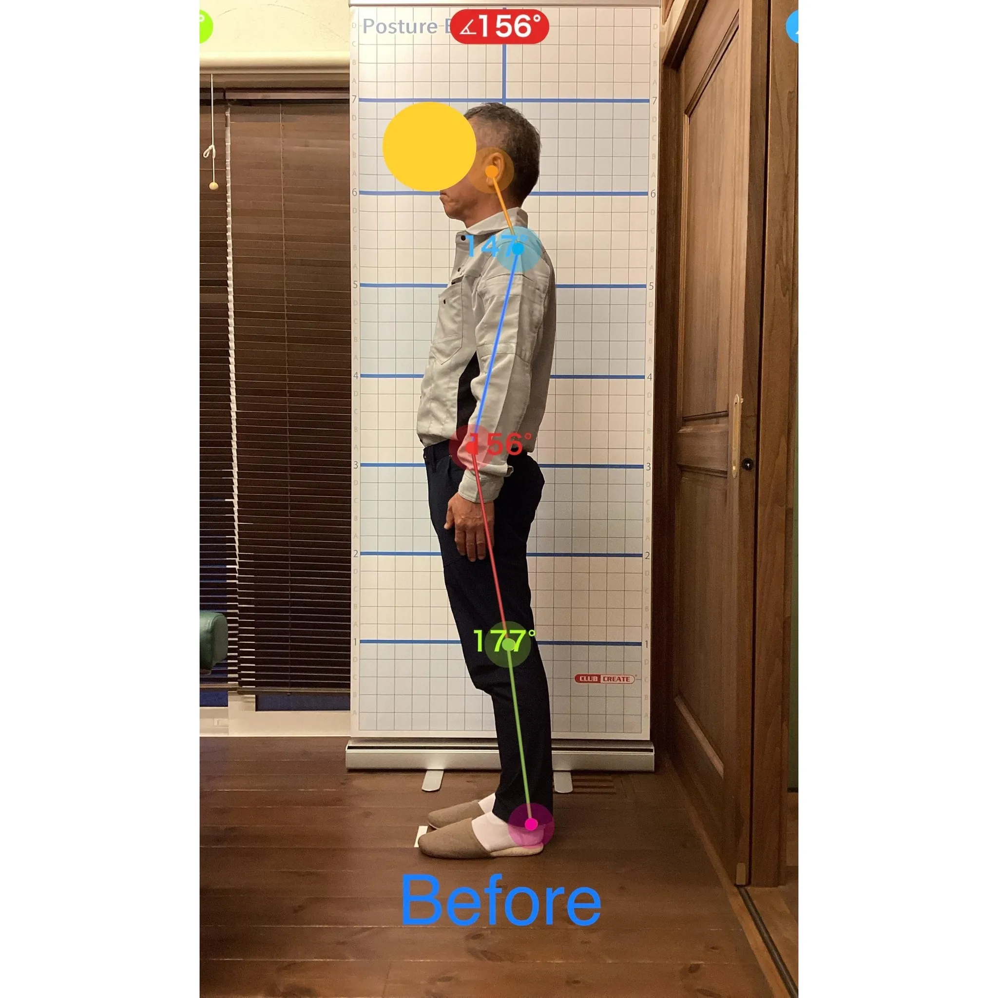 【富里 整体】腰痛、肘のシビレ、脹脛の痛み 他/50代男性/...