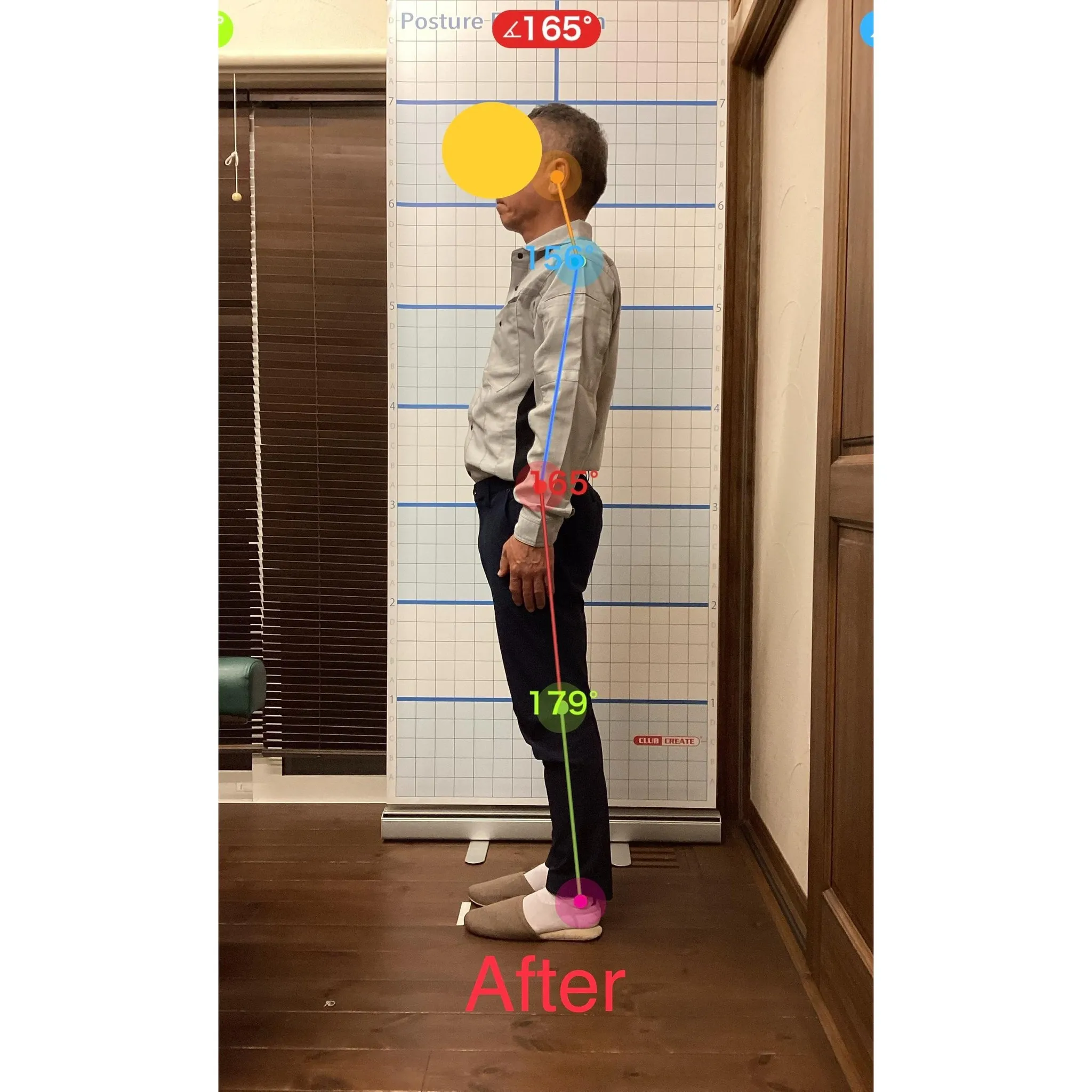 【富里 整体】腰痛、肘のシビレ、脹脛の痛み 他/50代男性/...