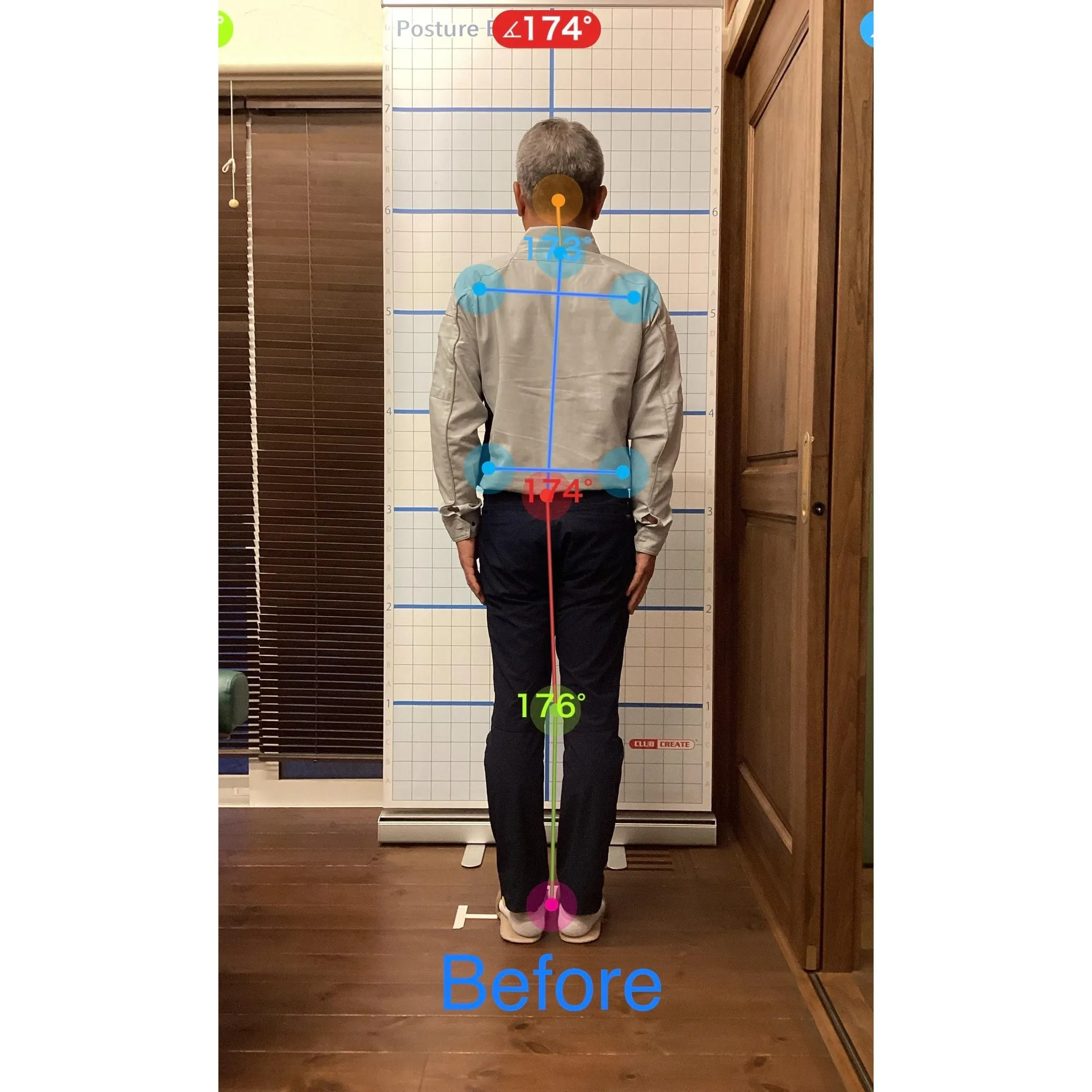 【富里 整体】腰痛、肘のシビレ、脹脛の痛み 他/50代男性/...