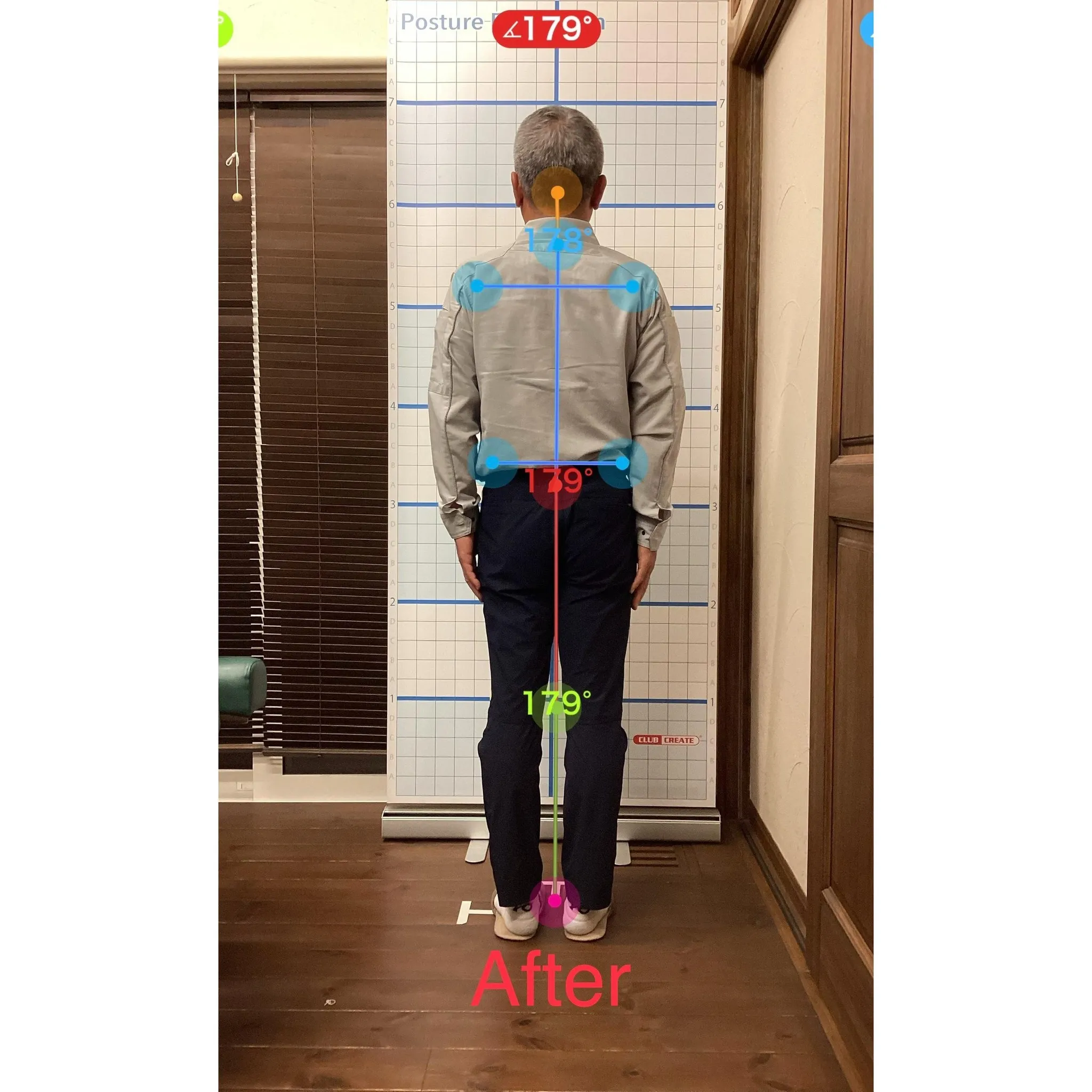 【富里 整体】腰痛、肘のシビレ、脹脛の痛み 他/50代男性/...