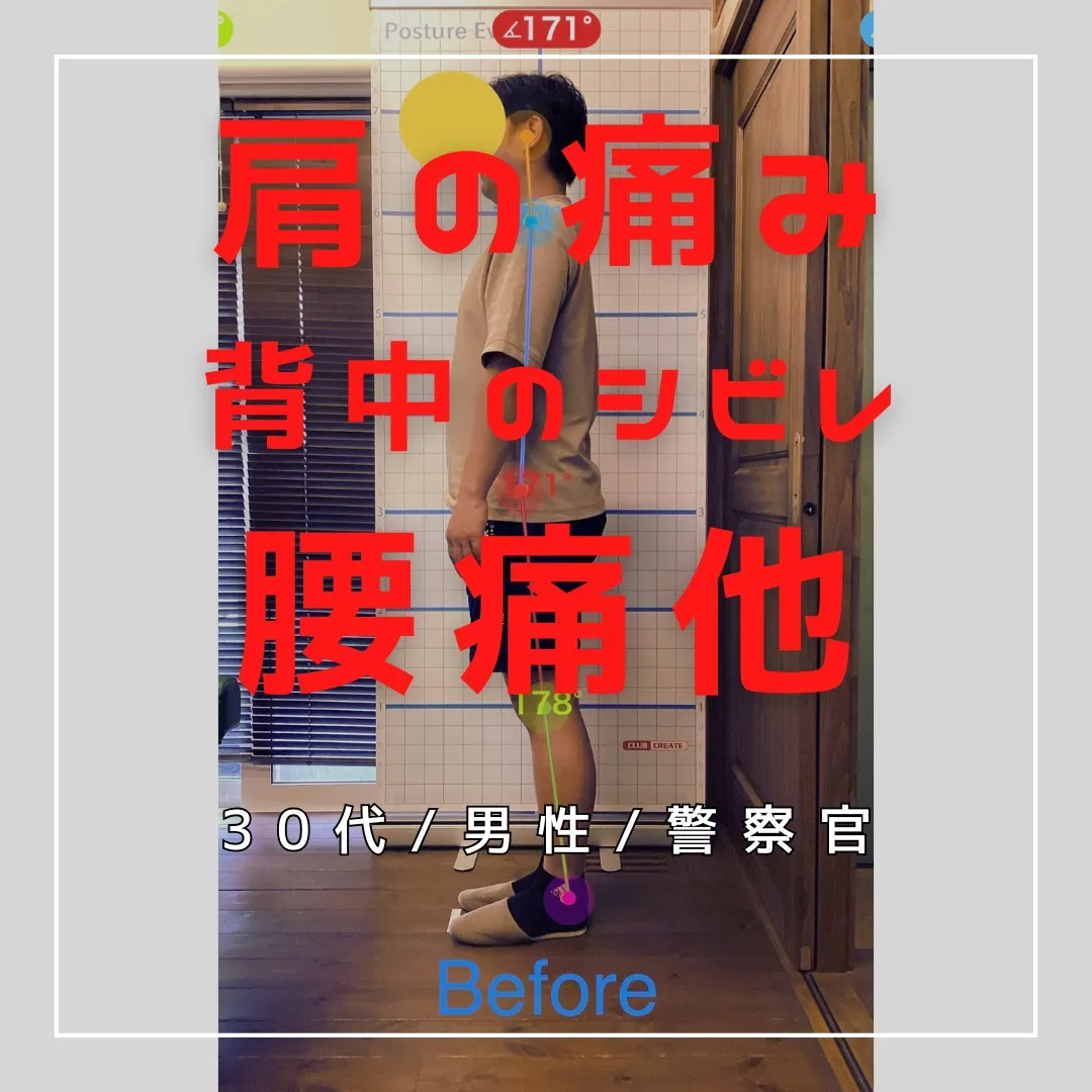 【富里 整体】左肩の痛み、腰痛、背中のシビレ 他/30代男性...