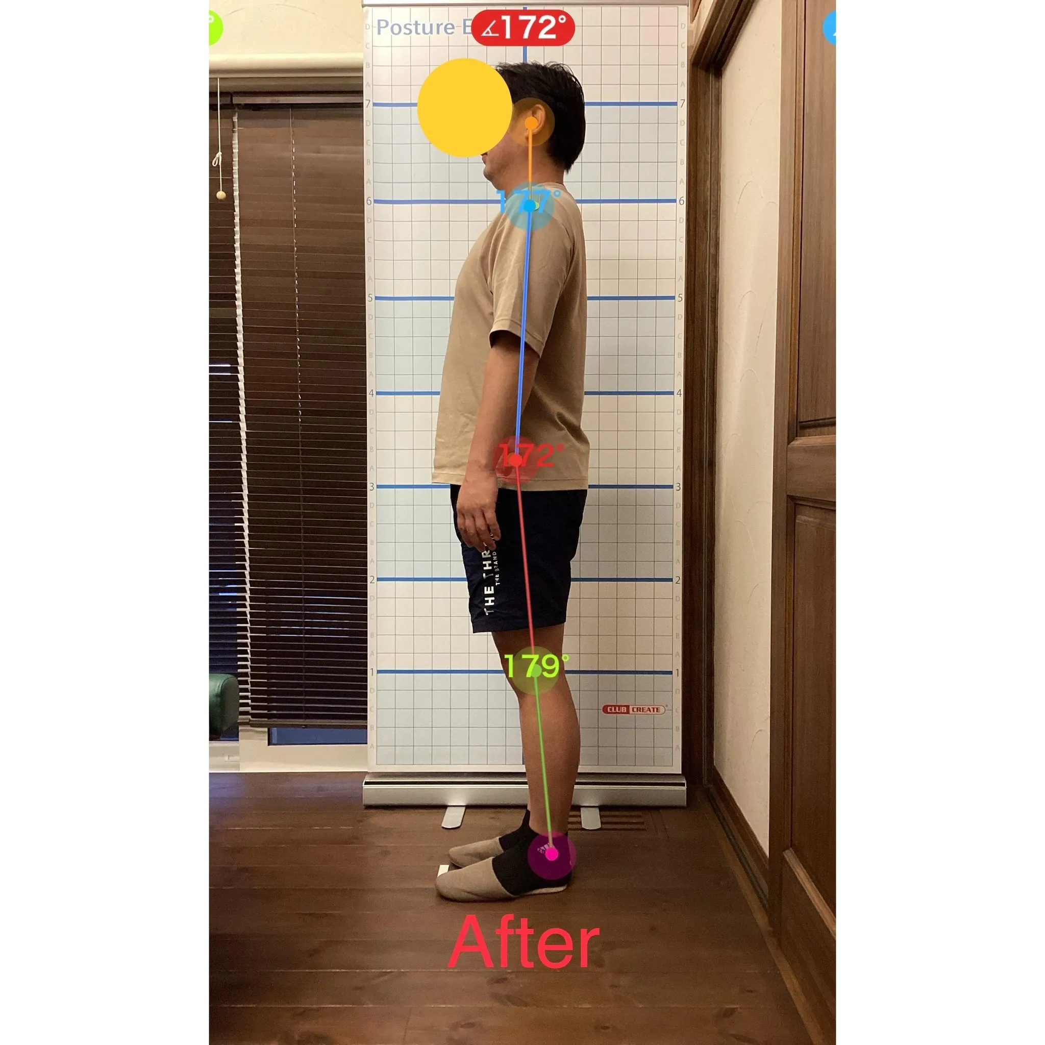 【富里 整体】左肩の痛み、腰痛、背中のシビレ 他/30代男性...