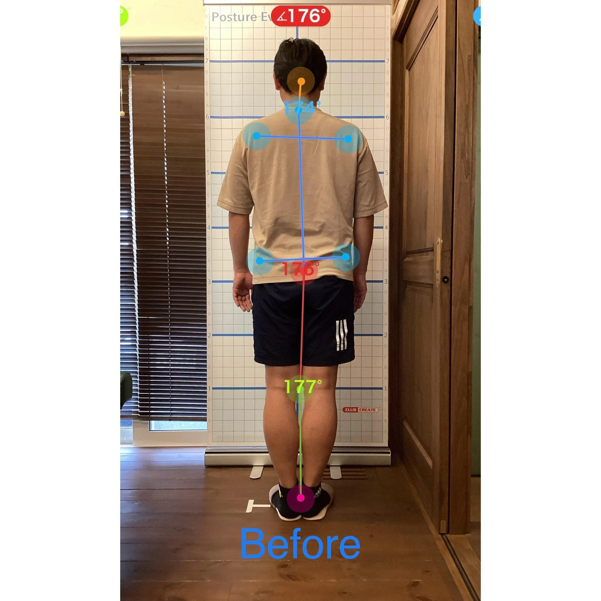 【富里 整体】左肩の痛み、腰痛、背中のシビレ 他/30代男性...